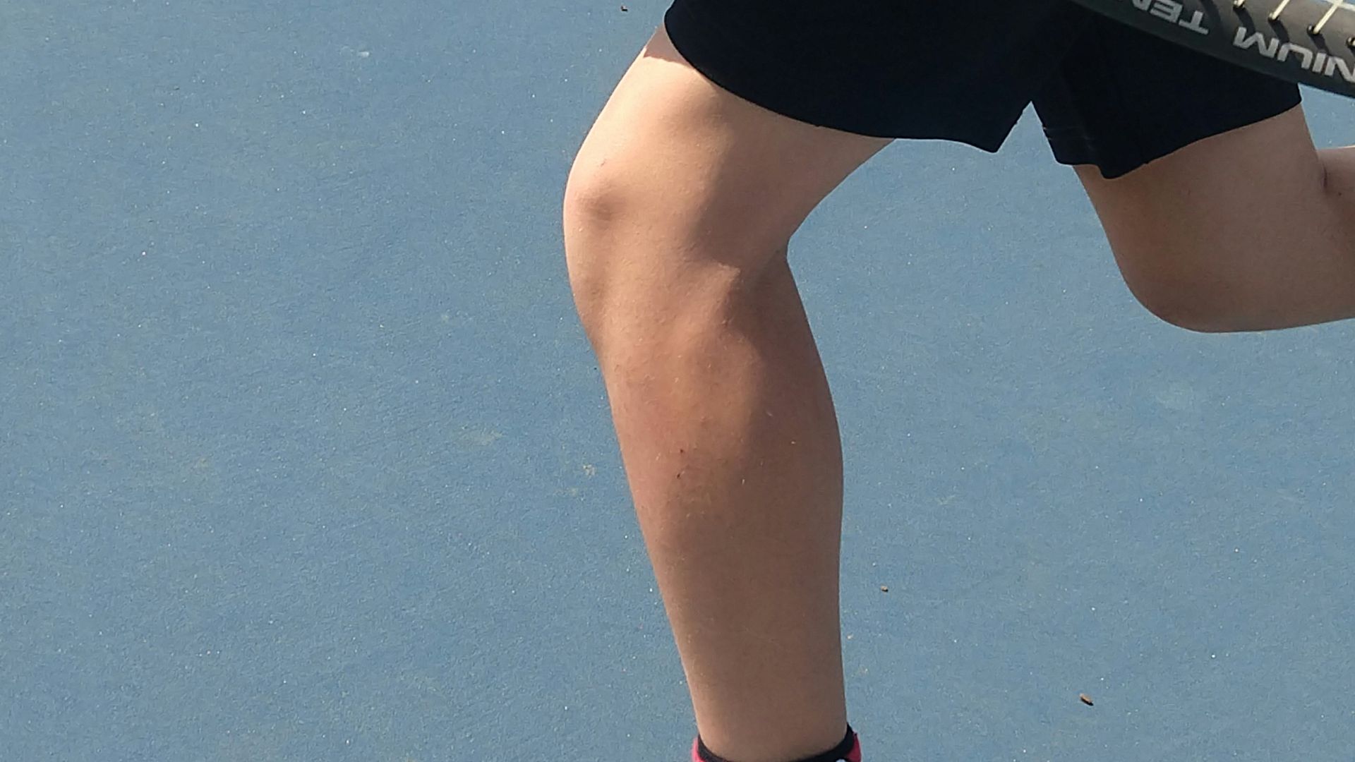 9. Soleus
