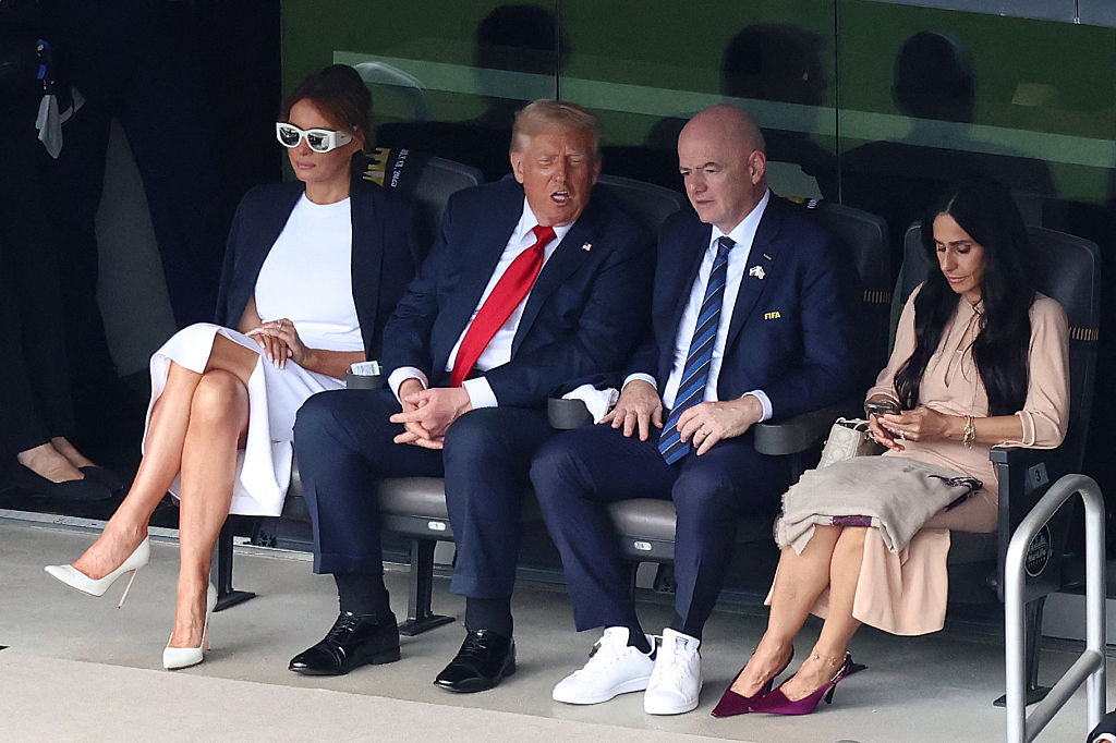L'insuffisance veineuse chronique de Trump