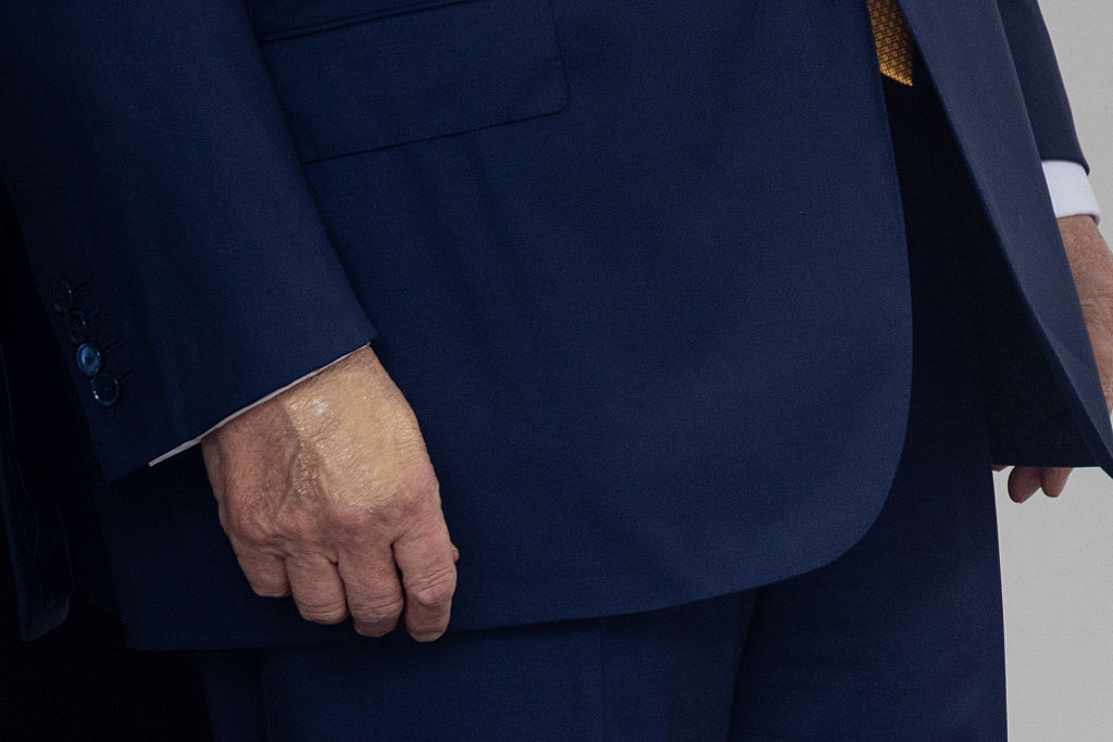 Entre aspirine et poignées de main