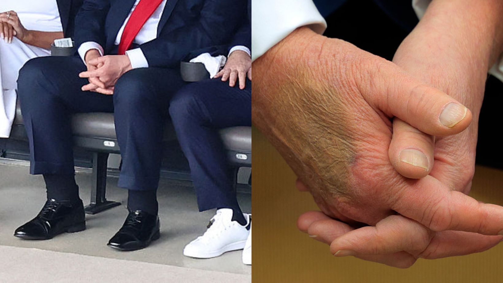 Trump gets official diagnosis