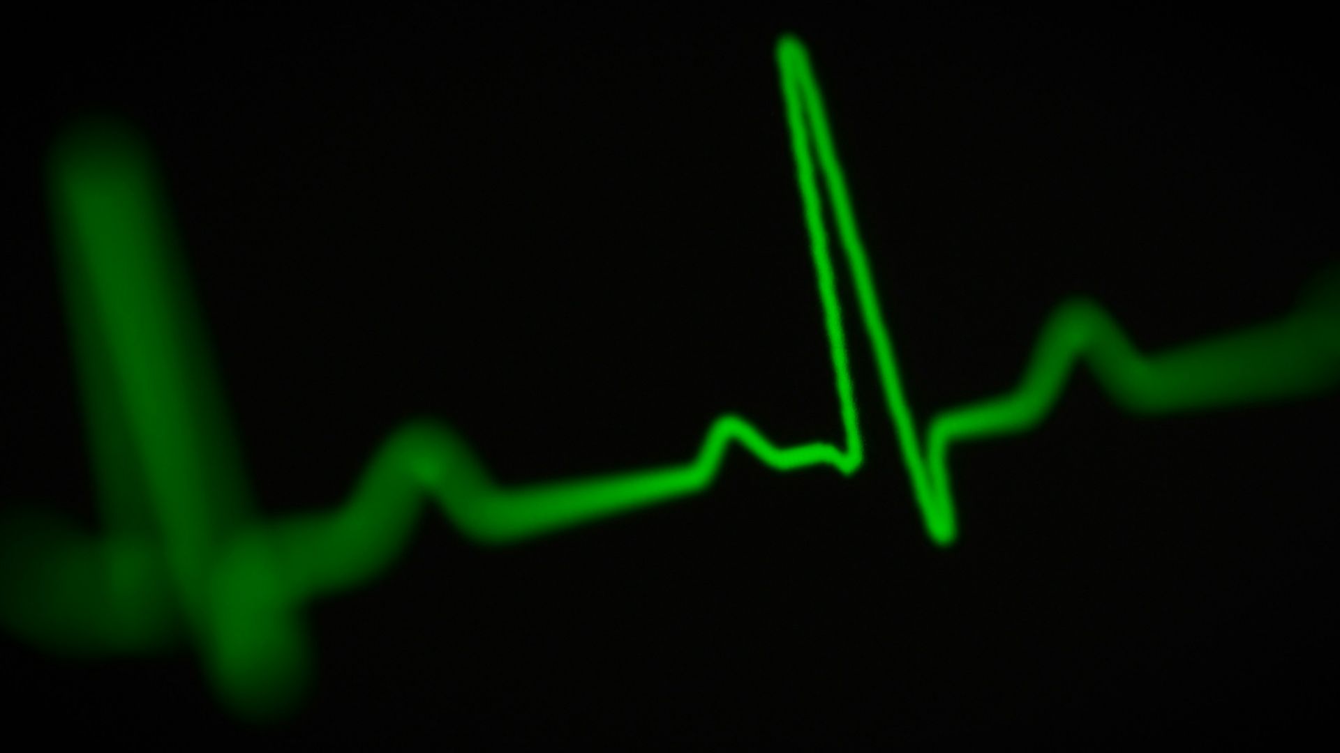 Diminuer la fréquence cardiaque