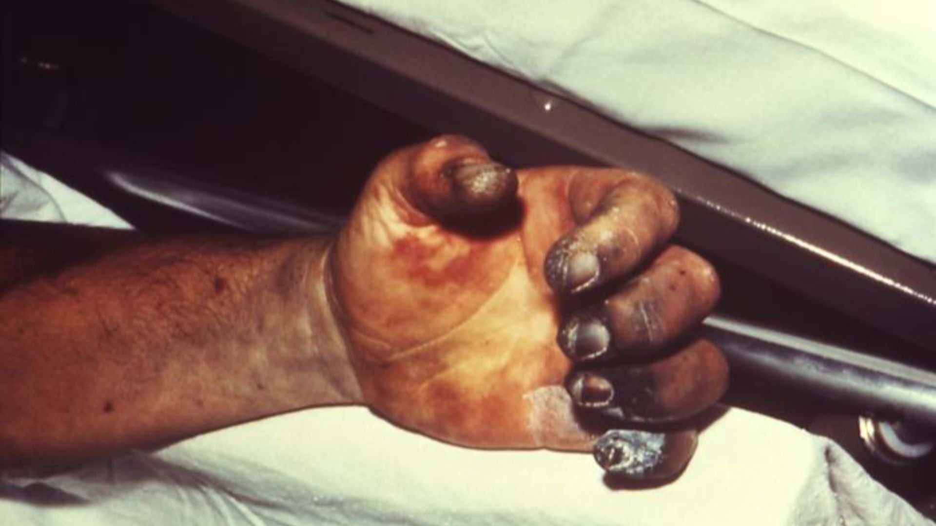 5. La peste noire