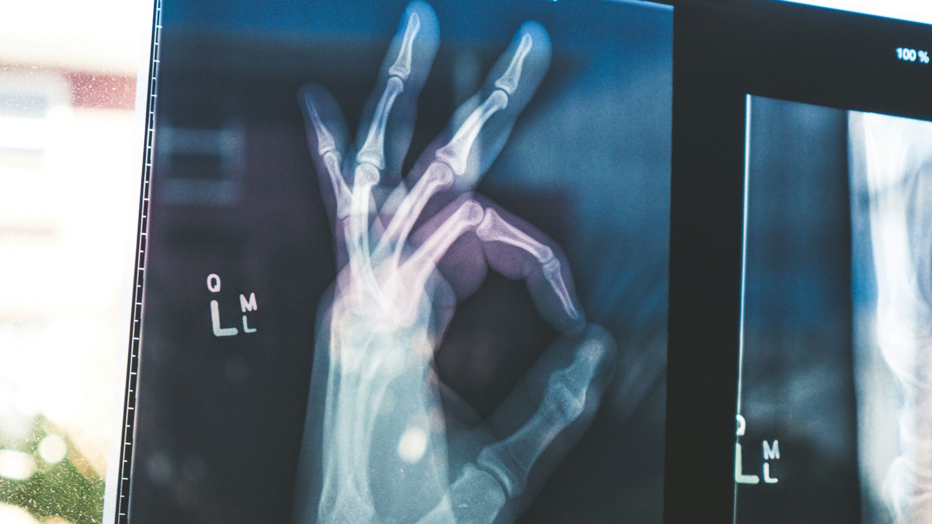 20 découvertes accidentelles étonnantes qui ont changé l’histoire