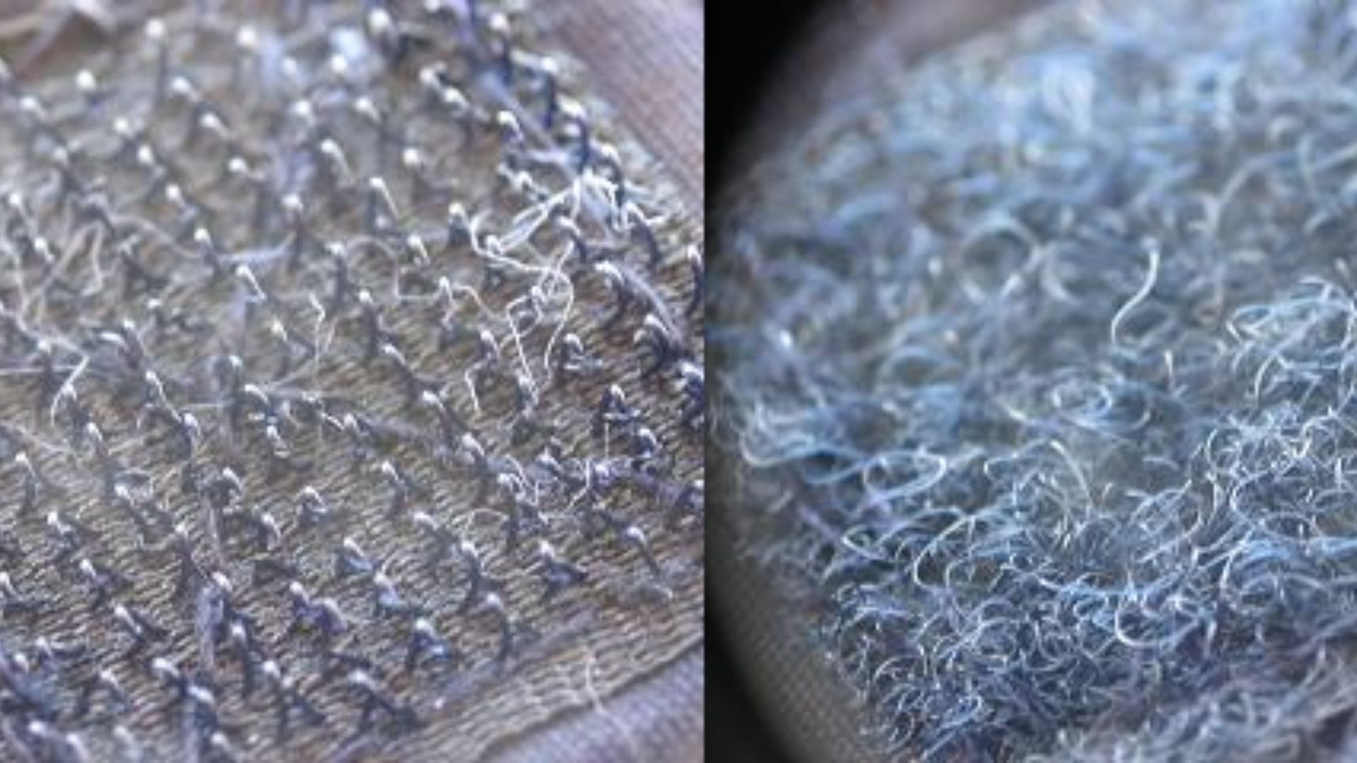 3. Velcro