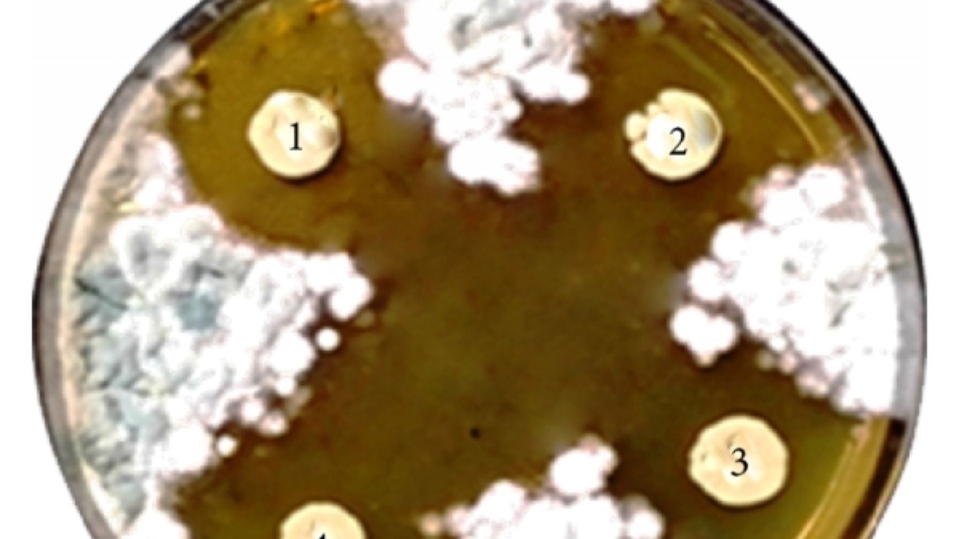 10. Médicaments antifongiques
