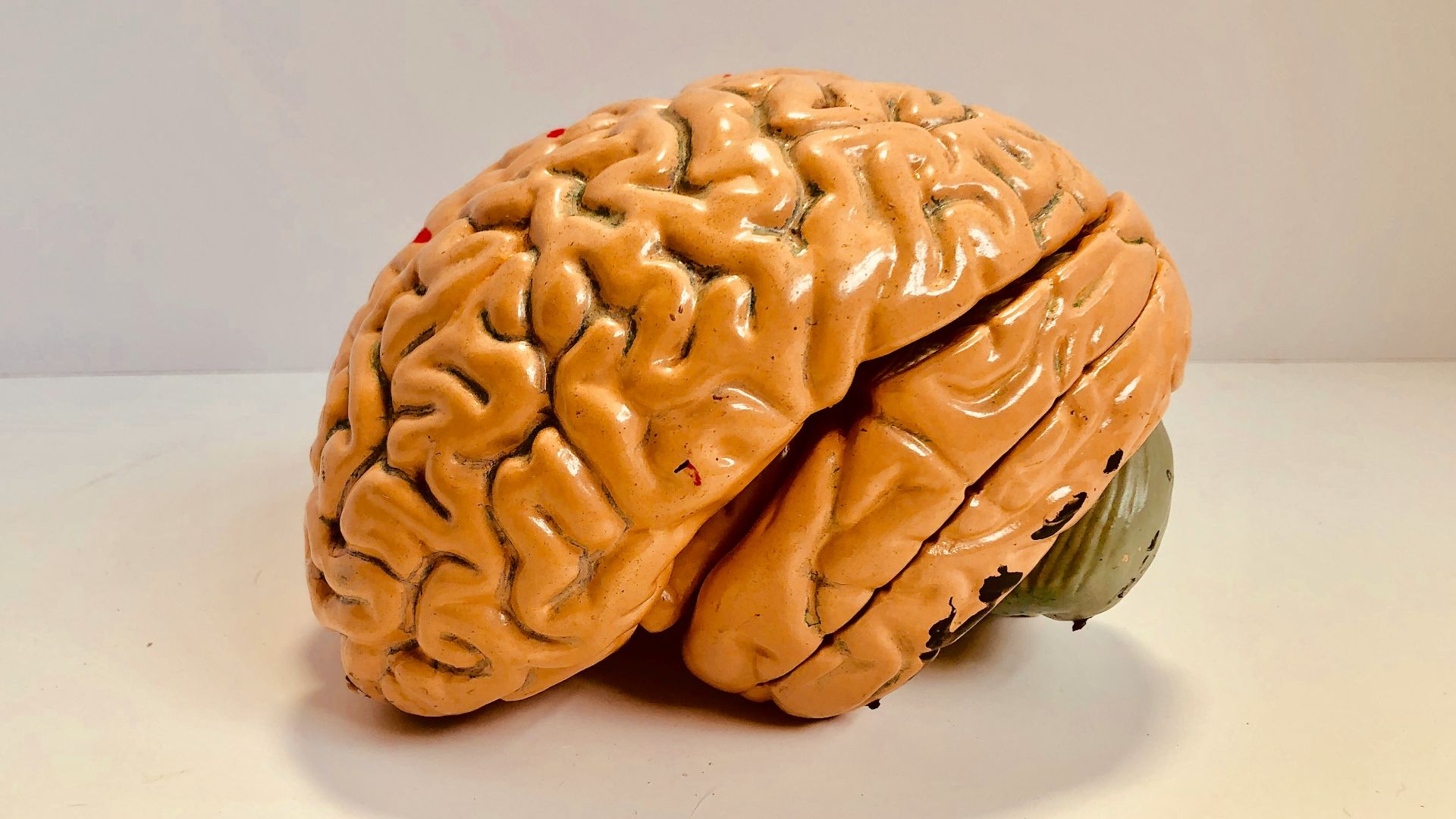 4. Brain Age