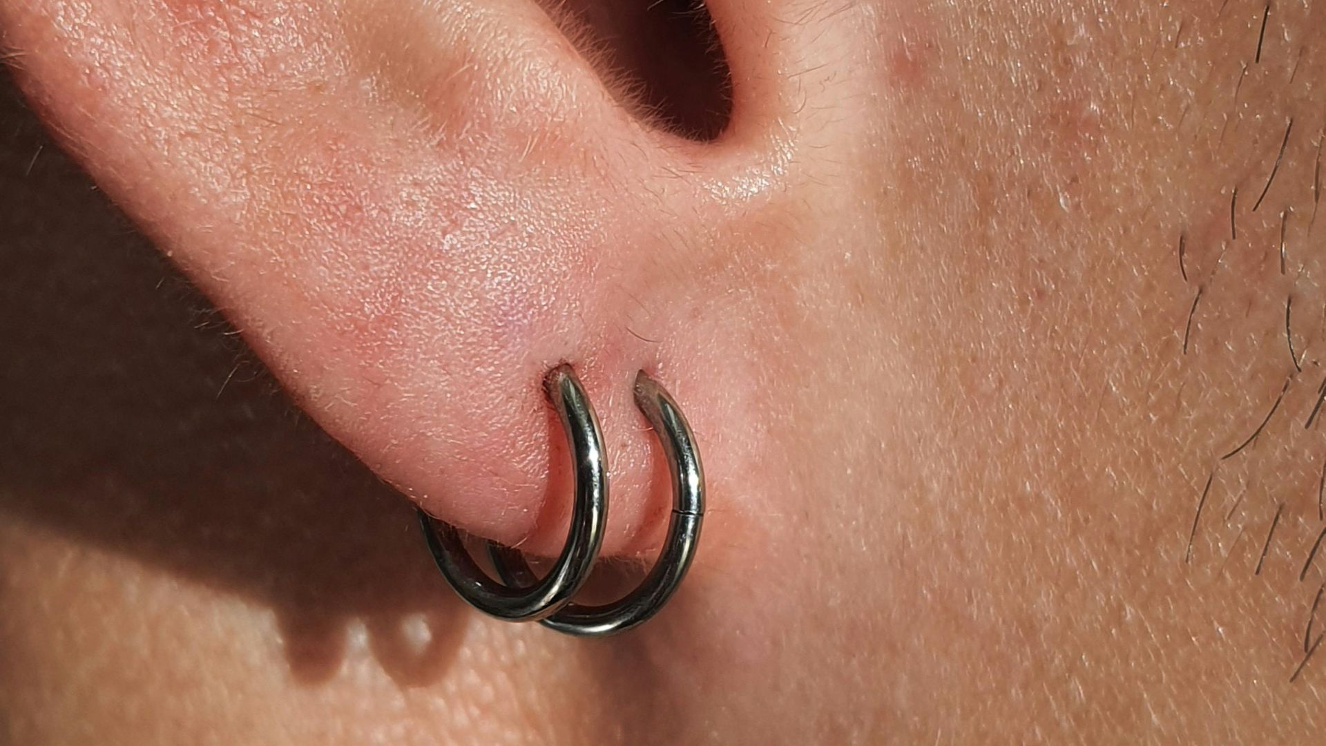 1. Lobe orbitale de l'oreille