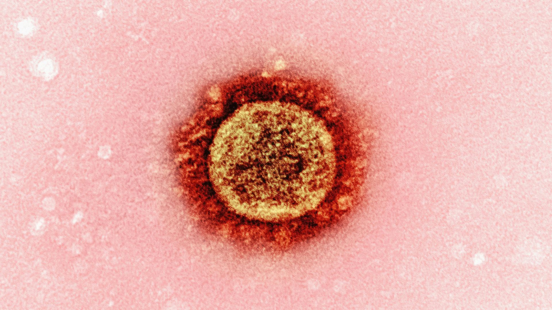 7. Typhoïde