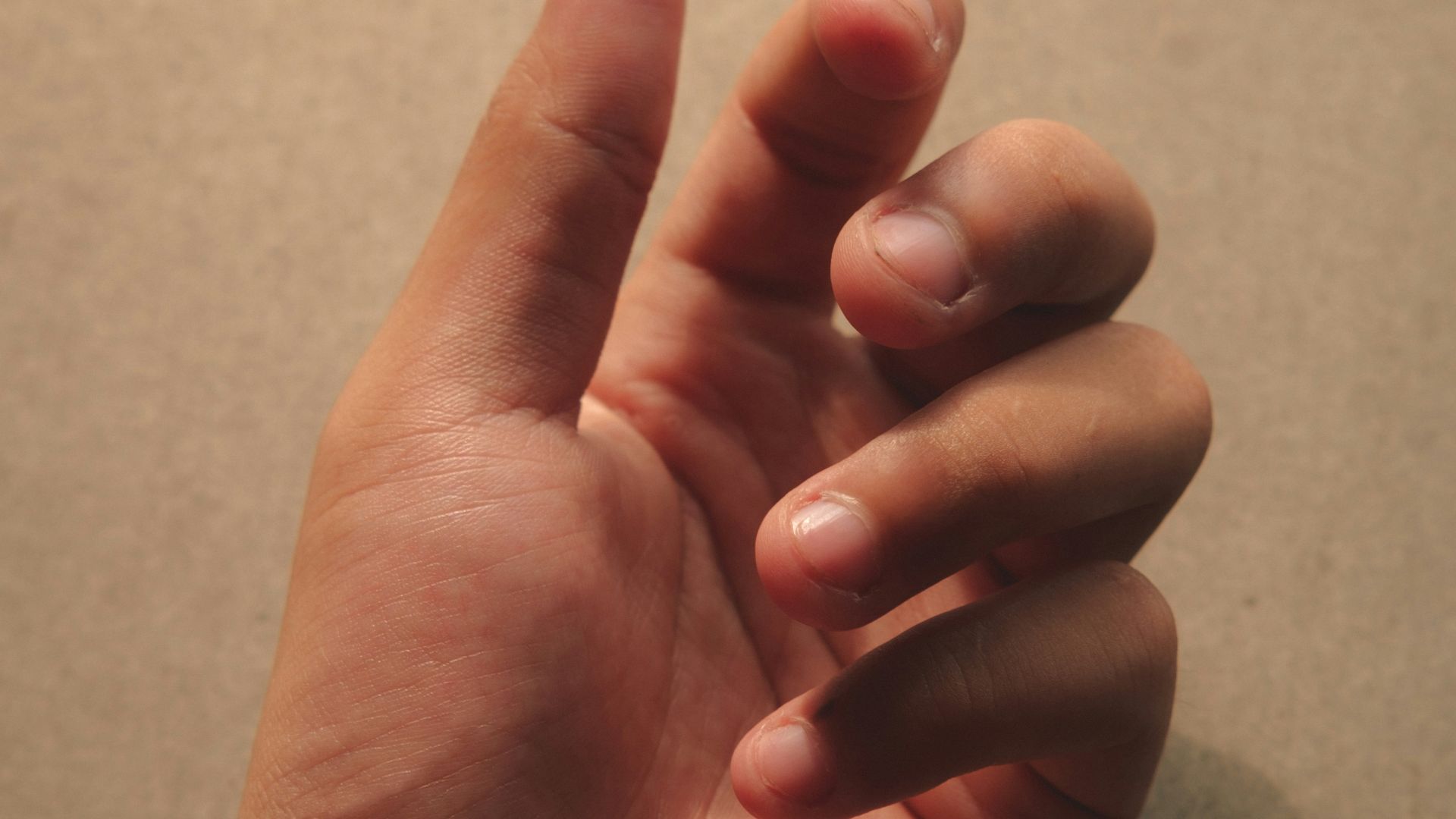 3. Ongles cassants ou friables