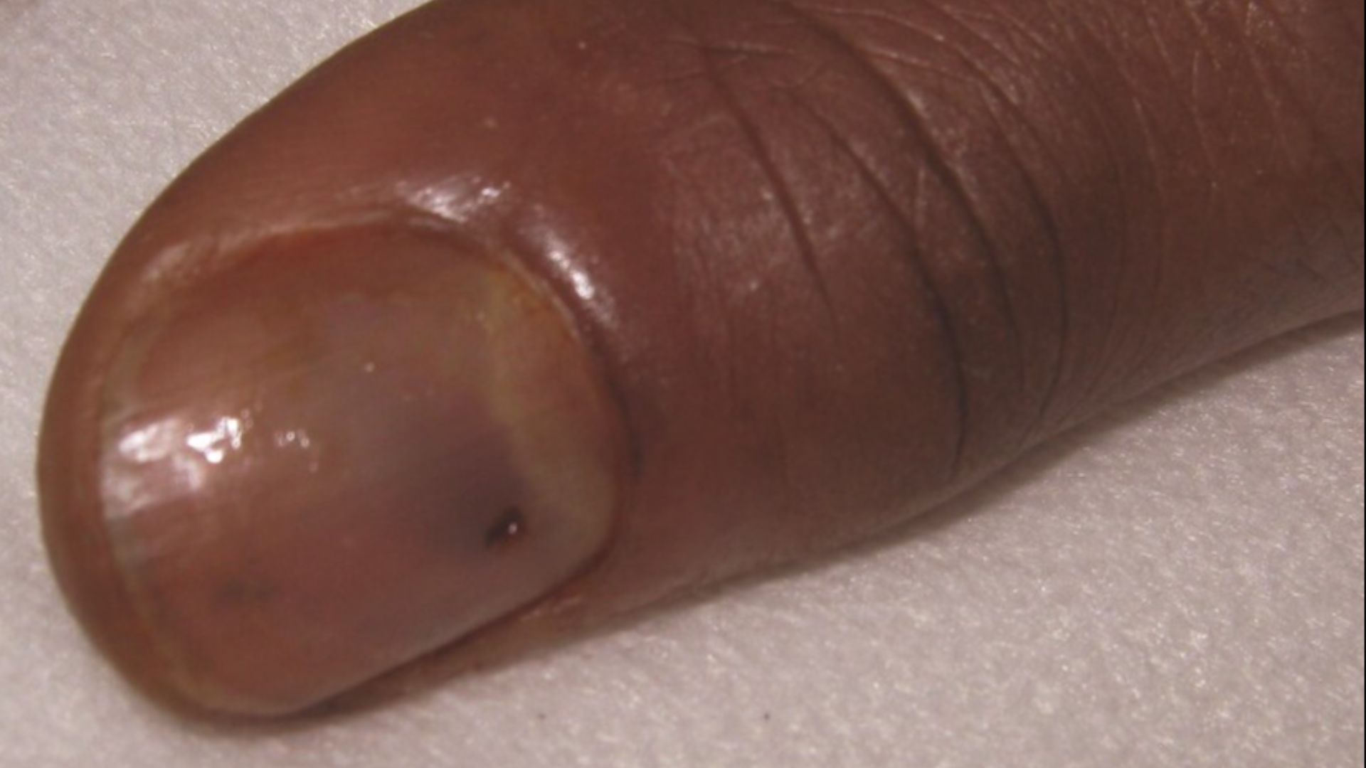 10. Ongles bleus ou violets