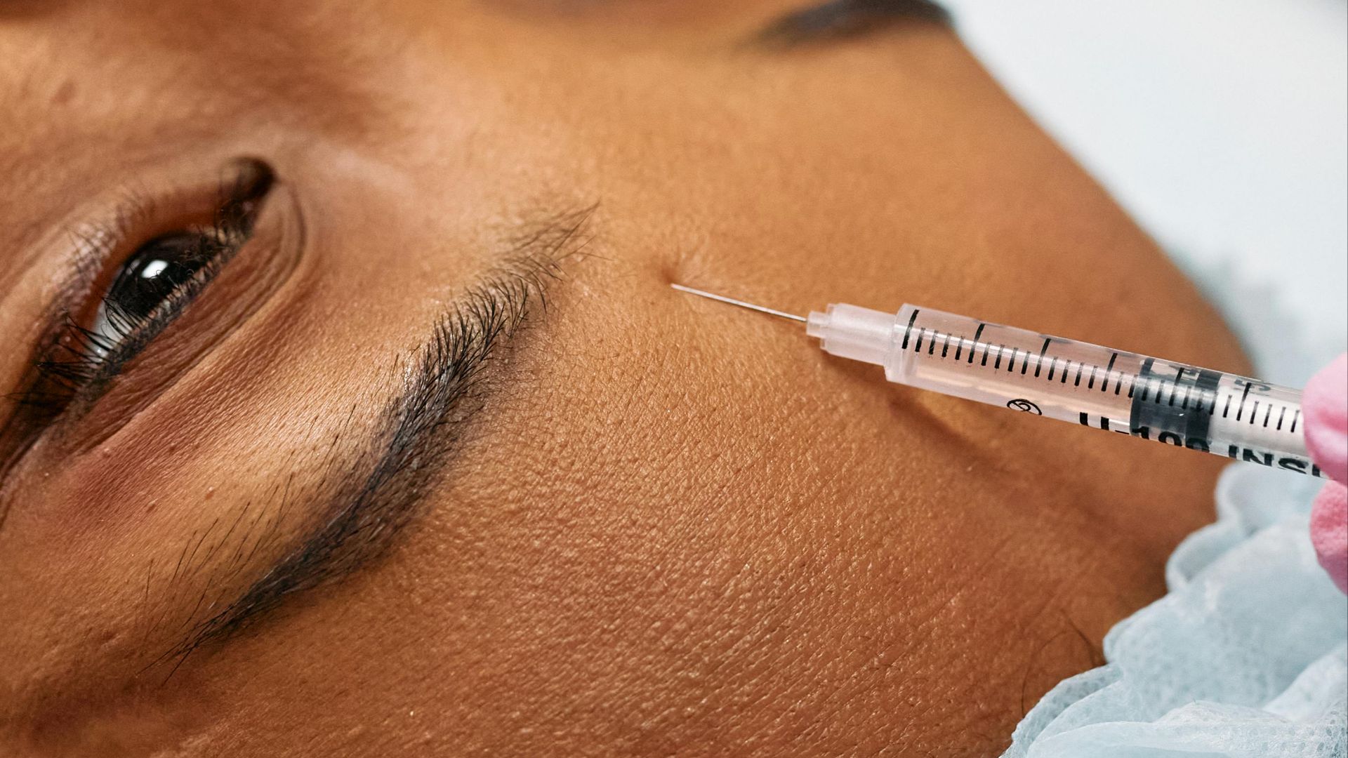 9. Vous avez reçu un traitement dermatologique