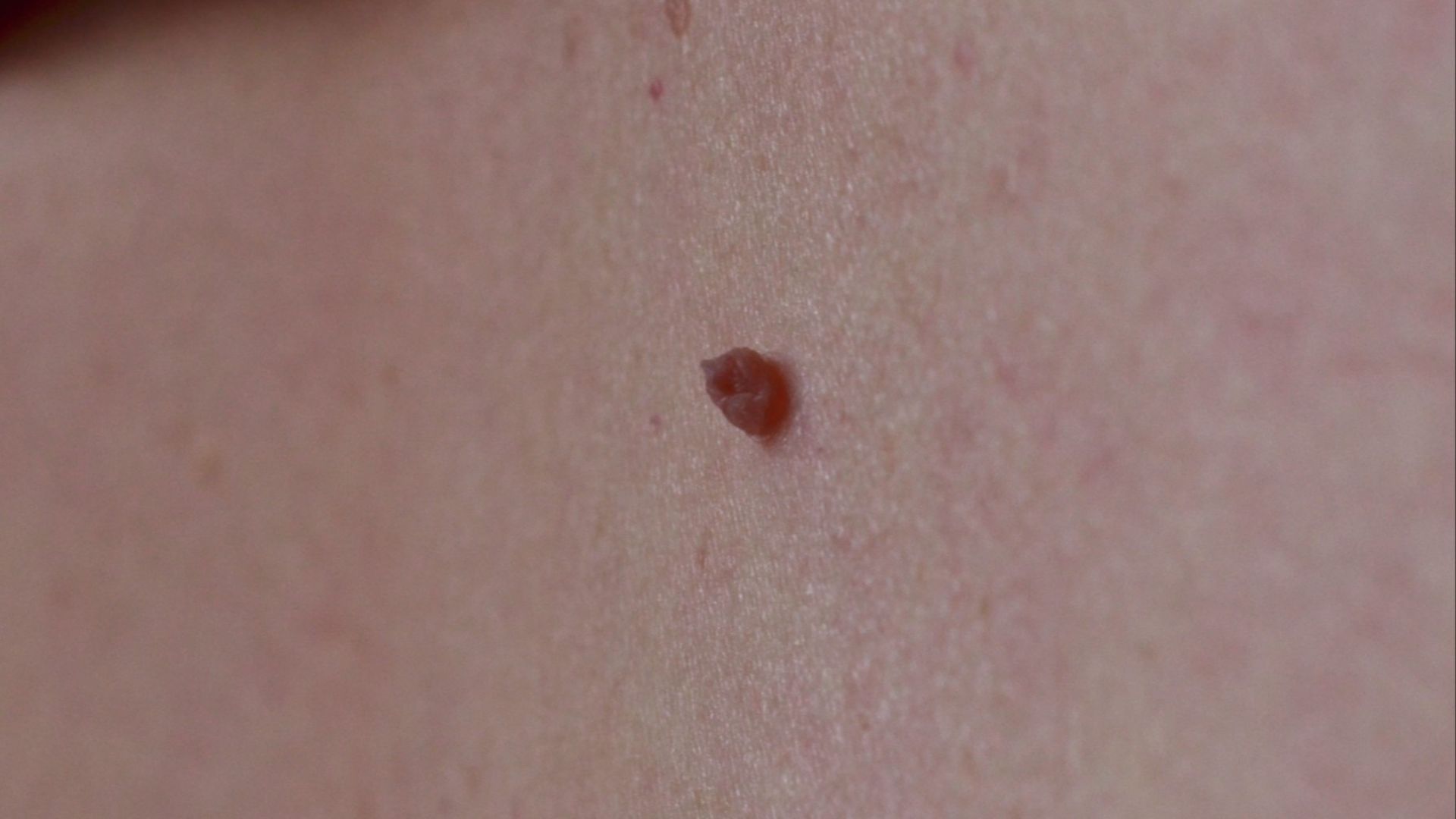5. Etiquettes de peau