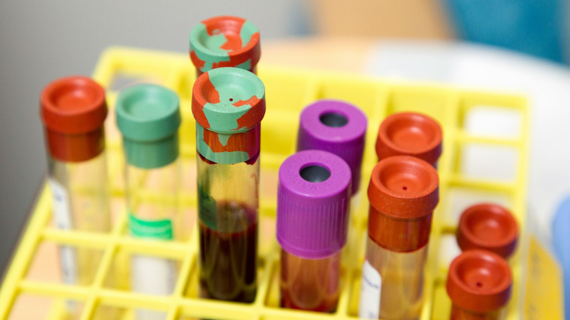 10. Panels génétiques avancés pour des pathologies spécifiques