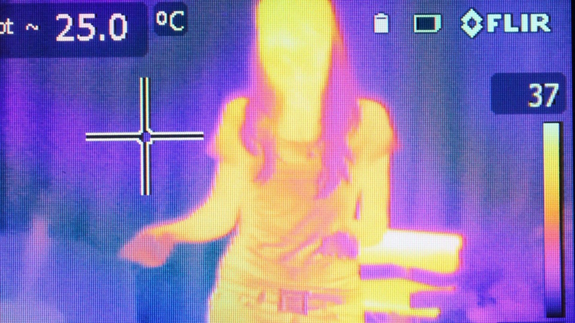 3. La thermographie pour la détection du cancer