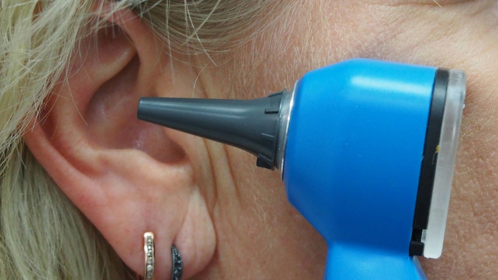 9. Peut aider à soulager les acouphènes