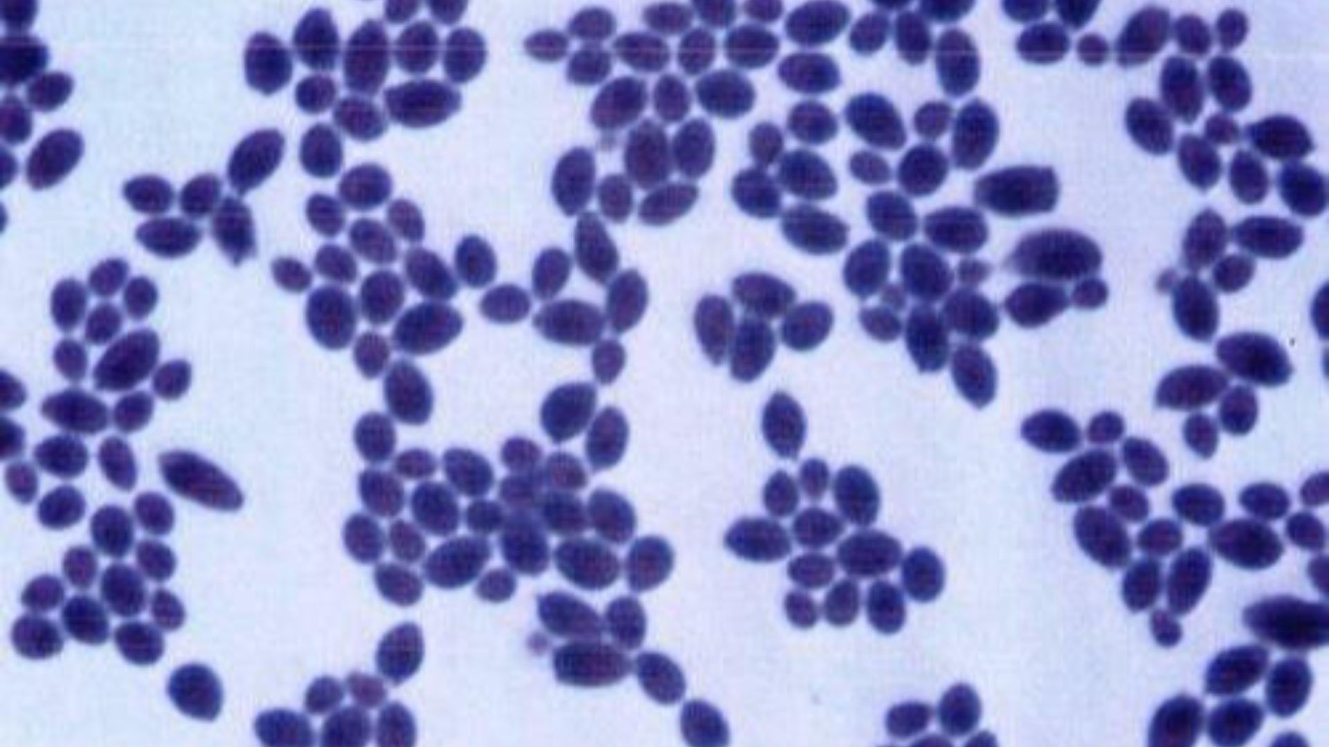 4. Saccharomyces boulardii