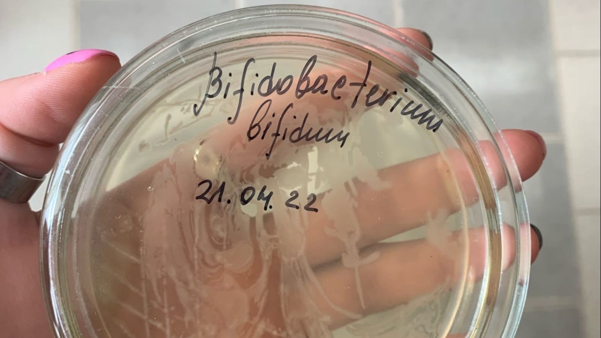 5. Bifidobacterium bifidum
