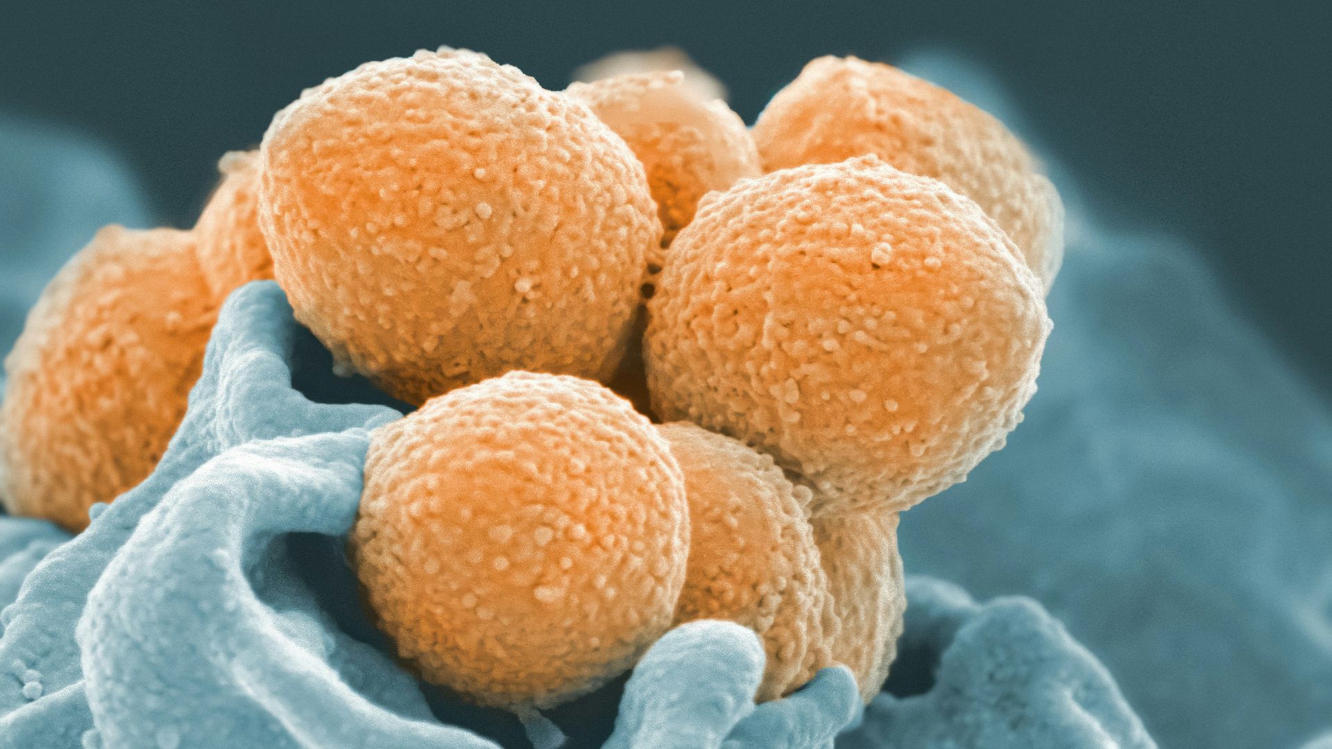 6. Lactobacillus casei