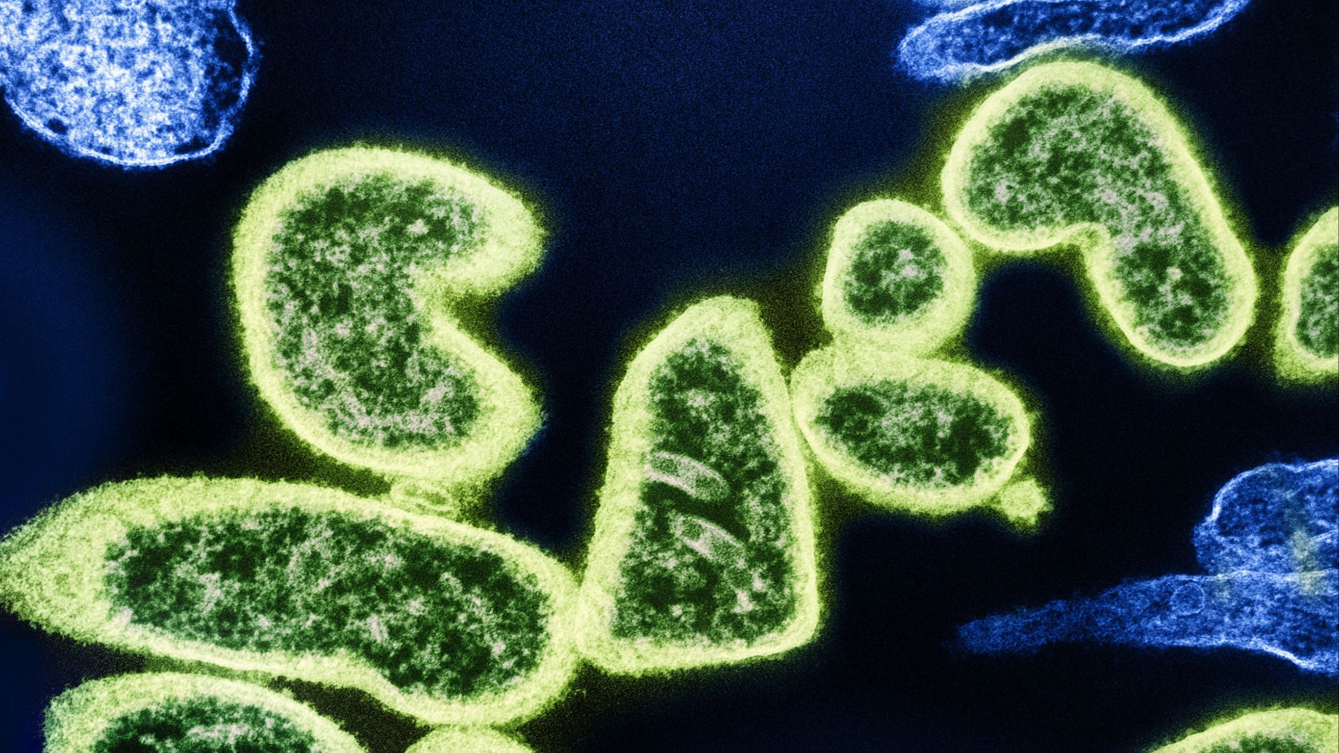 7. Bifidobacterium breve