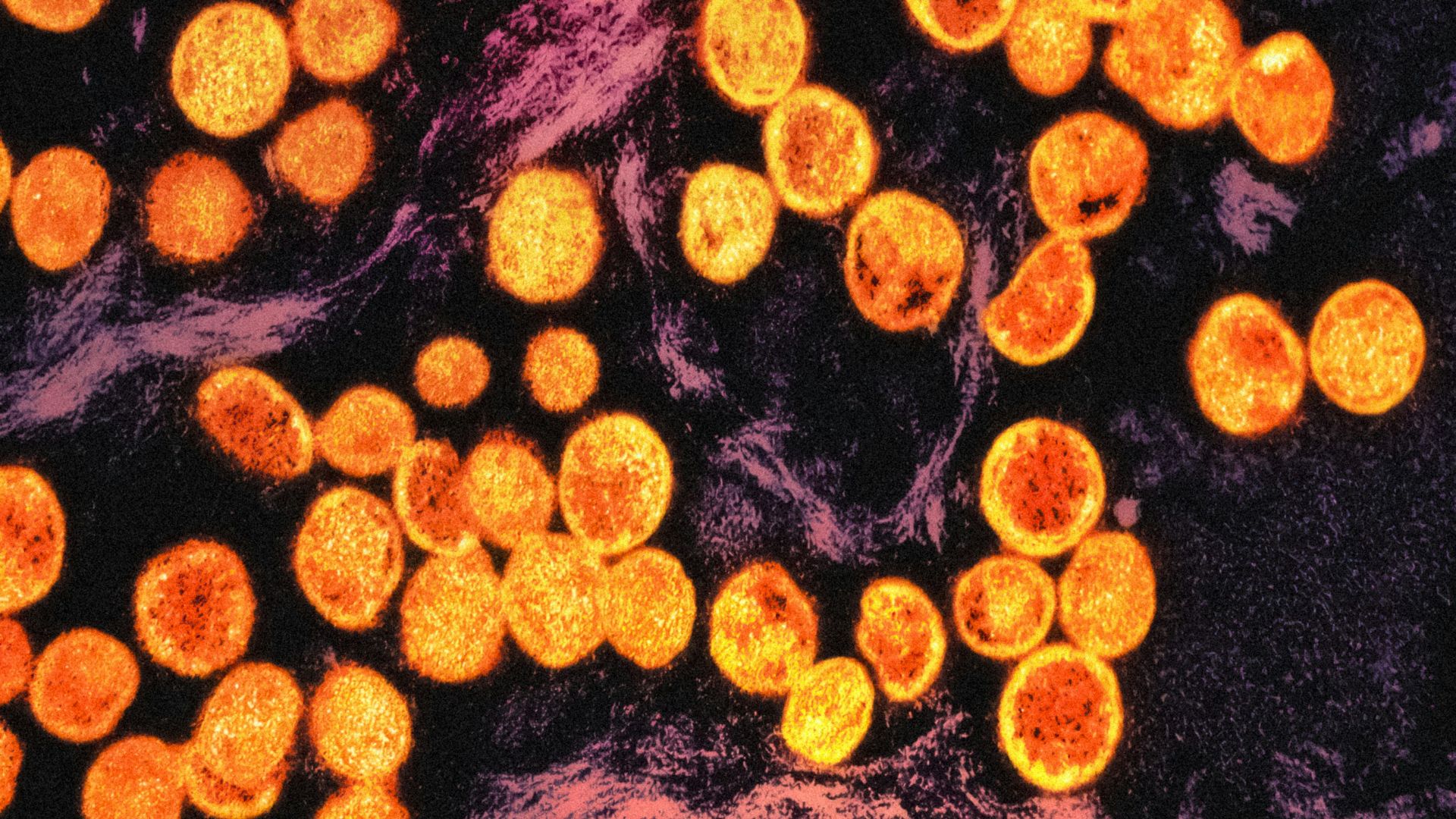 8. Lactobacillus reuteri