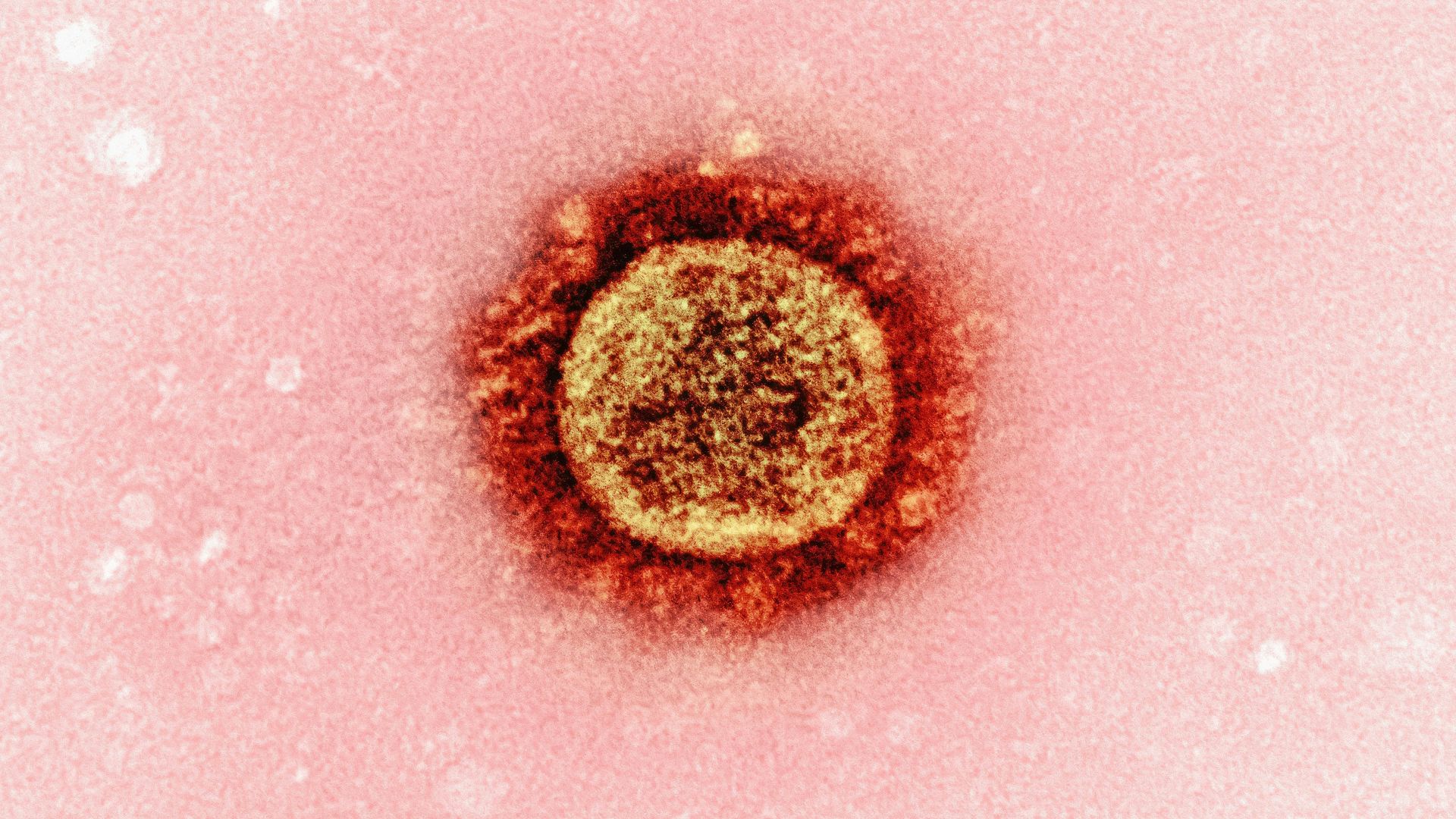 1. Lactobacillus bulgaricus