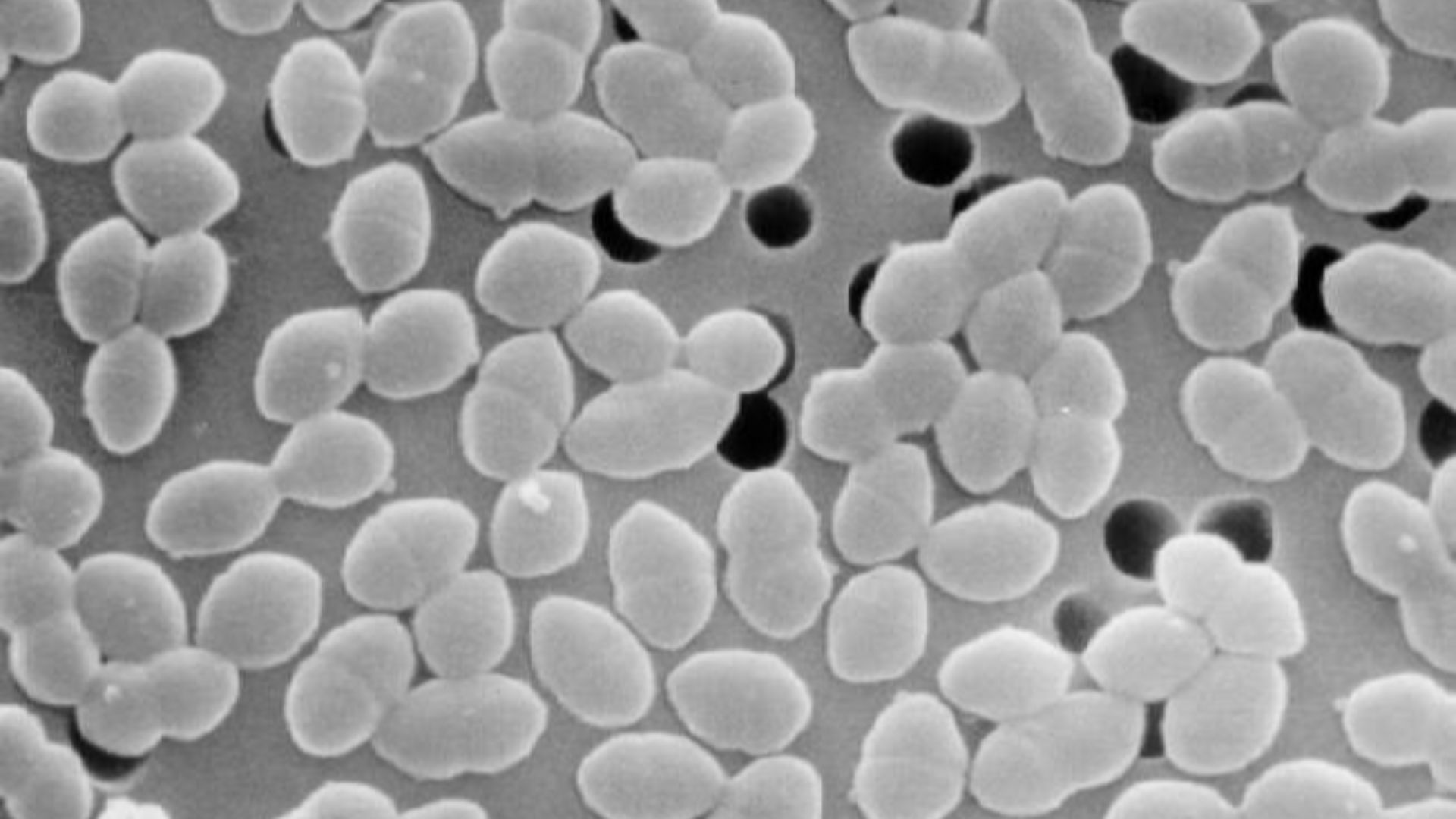 3. Enterococcus faecium