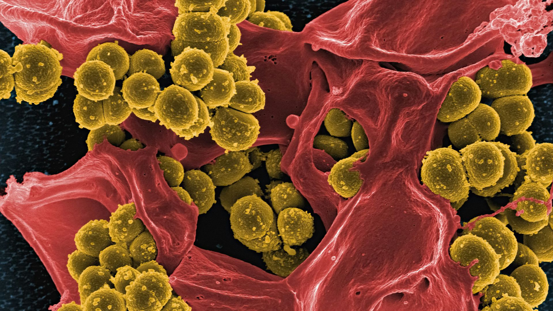 4. Lactobacillus gasseri
