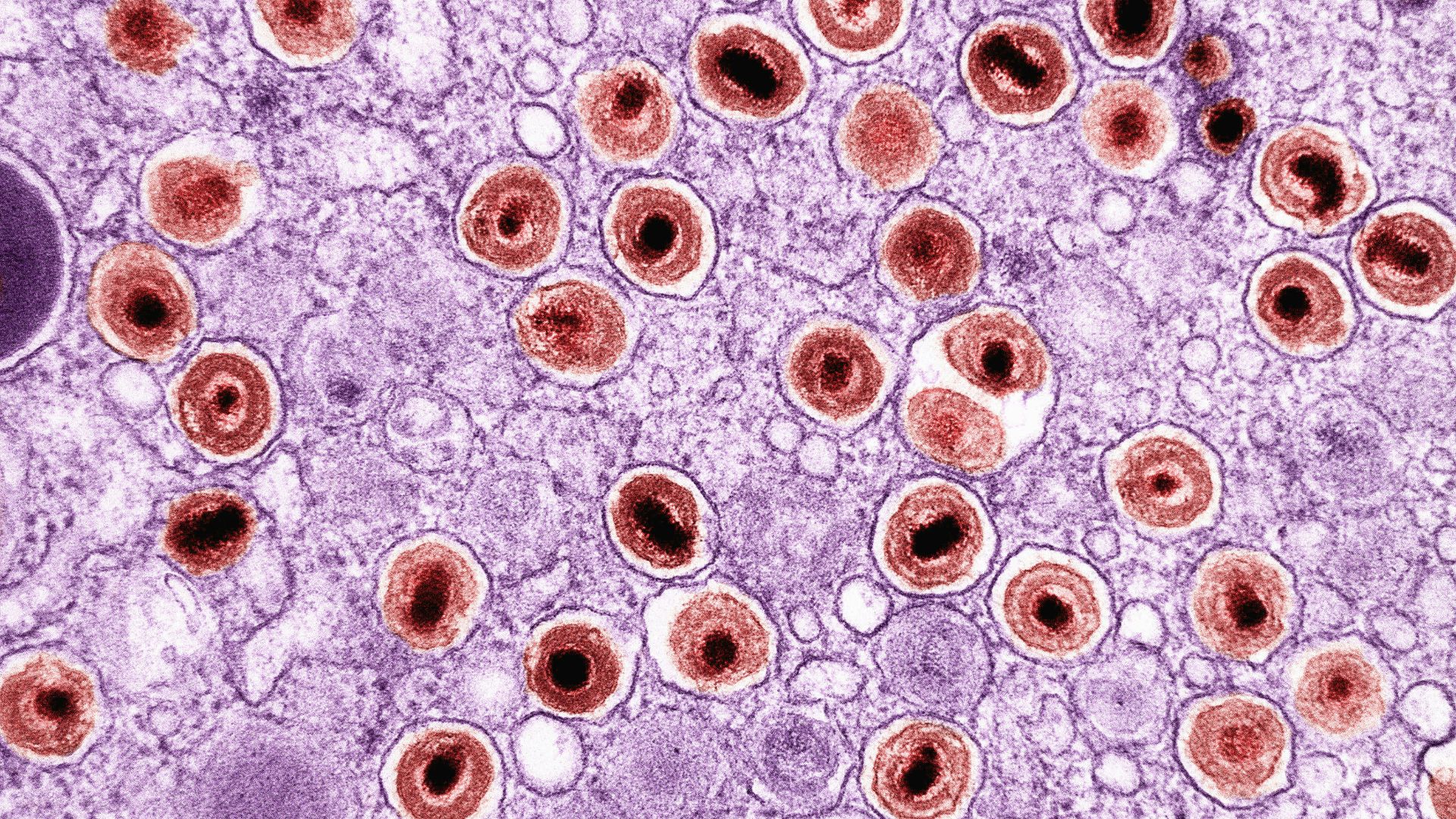 8. Lactobacillus helveticus