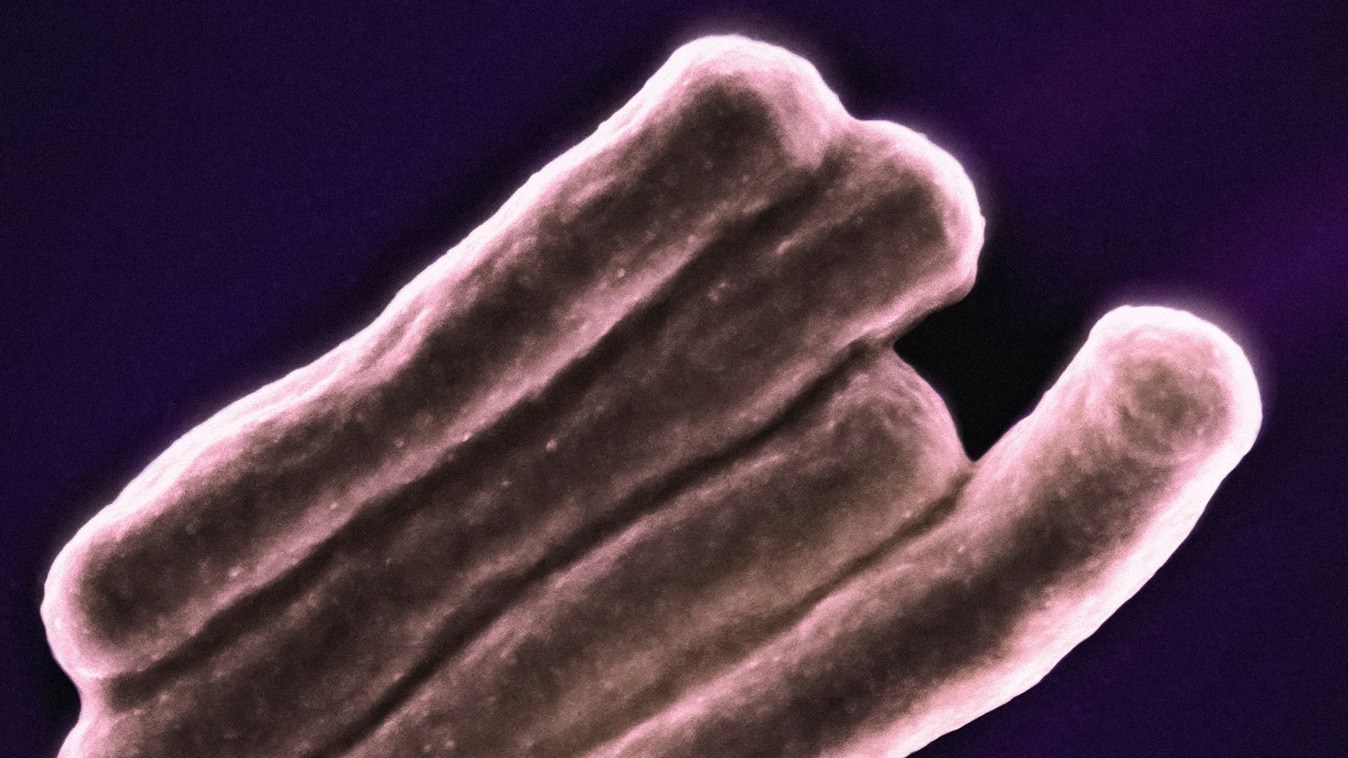10. Bifidobacterium animalis