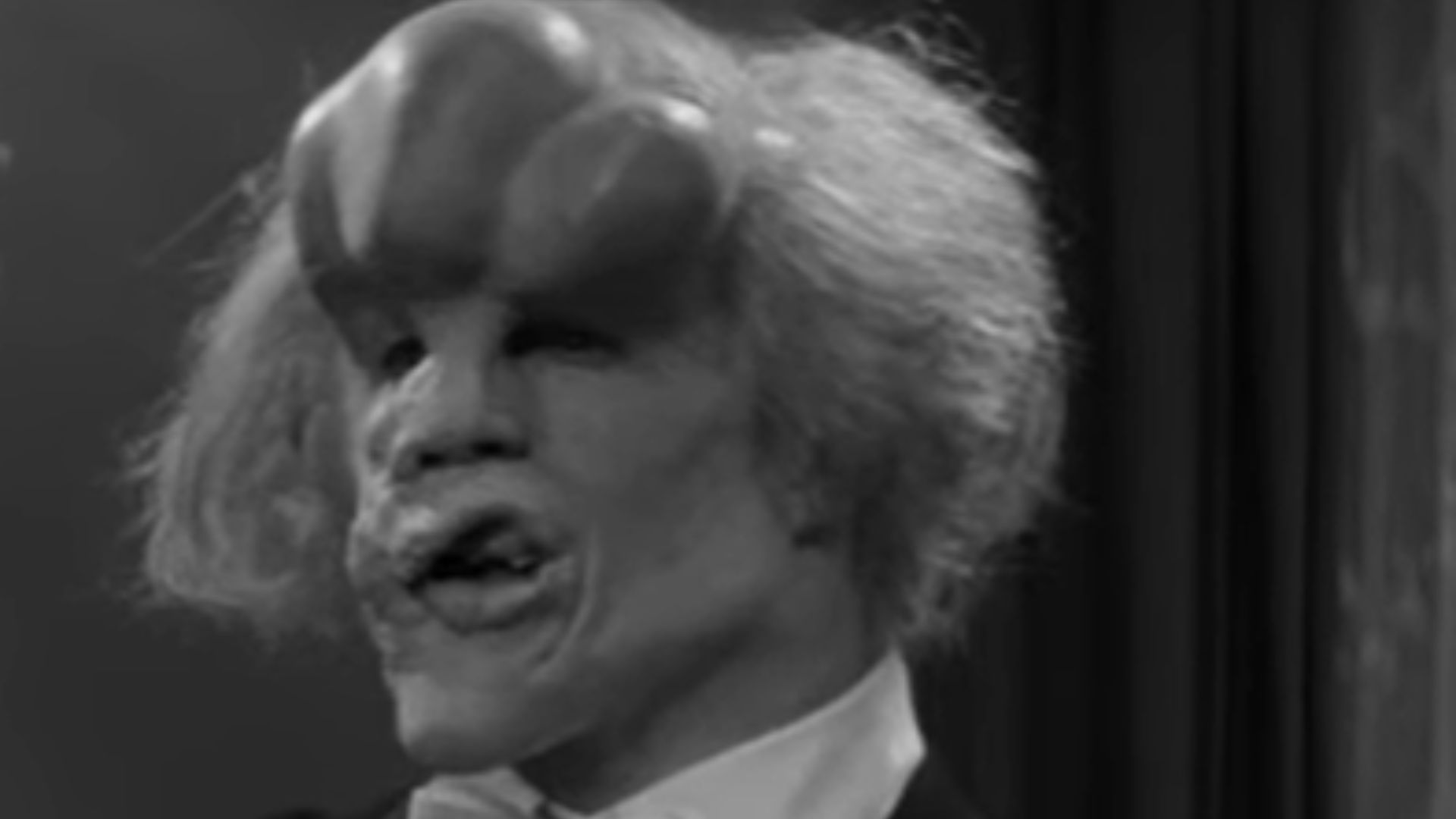 3. John Hurt dans le rôle de John Merrick dans Elephant Man