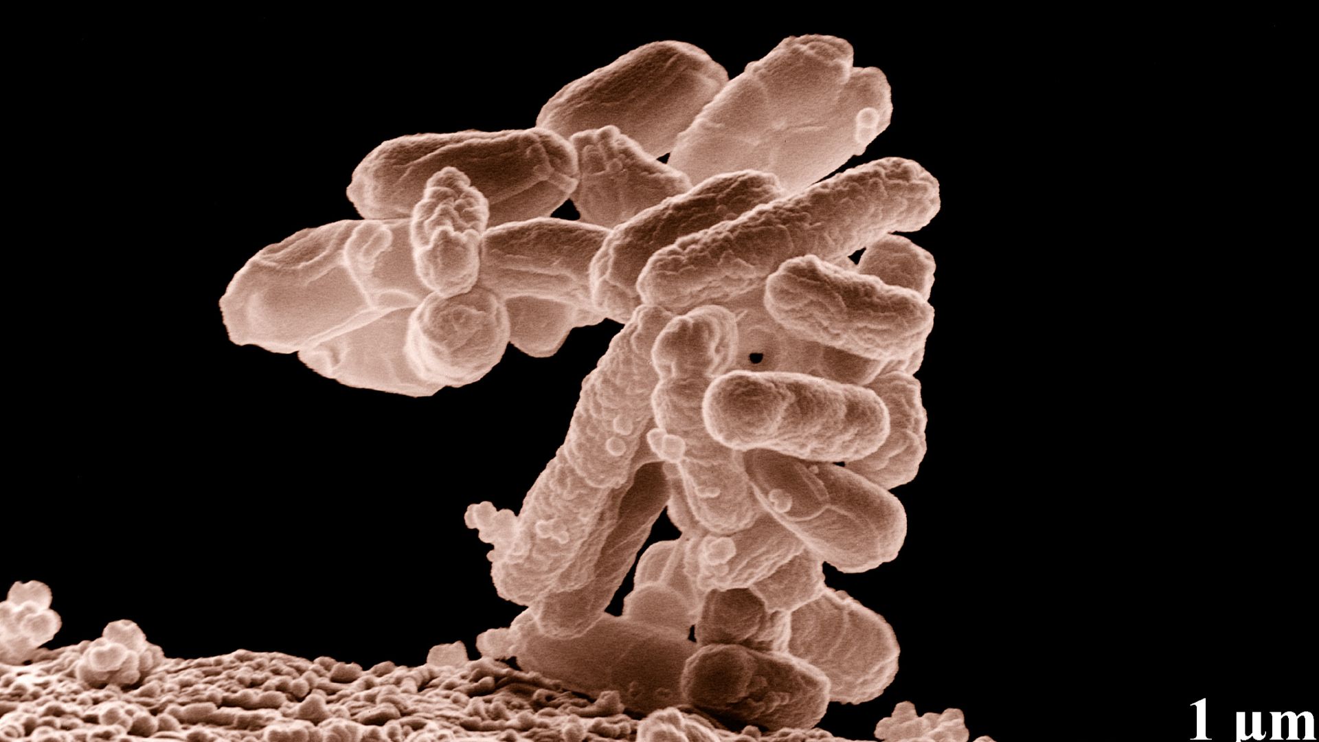 4. Thérapies de réparation du microbiome