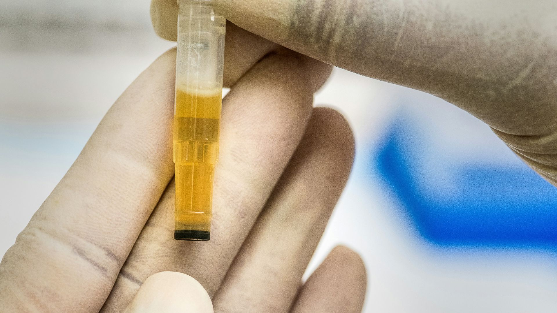 2. Utilisation de l'urine pour le nettoyage