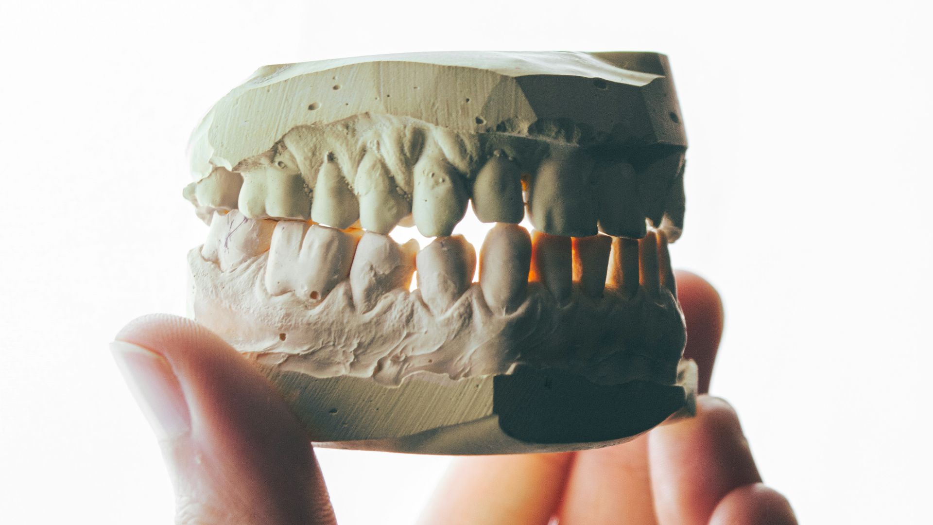 20. Extractions dentaires publiques