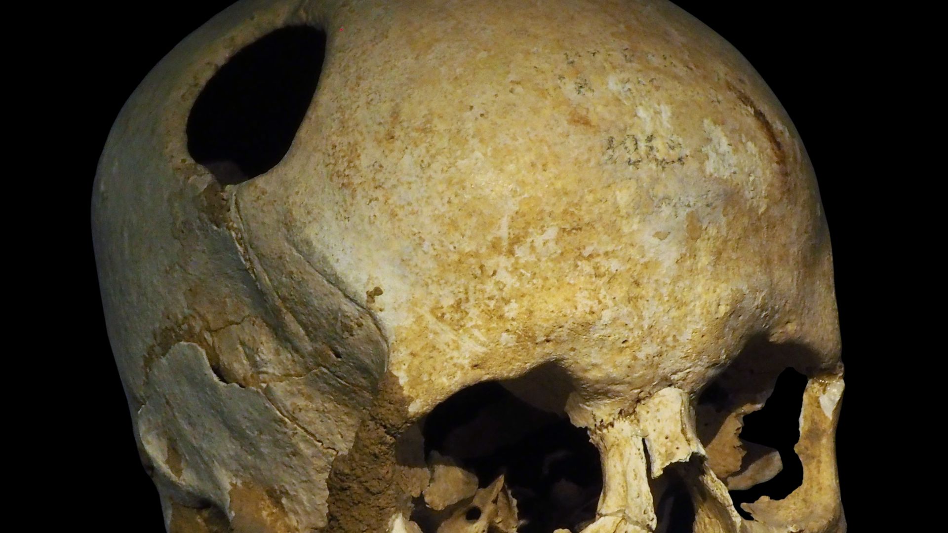 19. De nombreuses cultures ont percé des trous dans leur tête