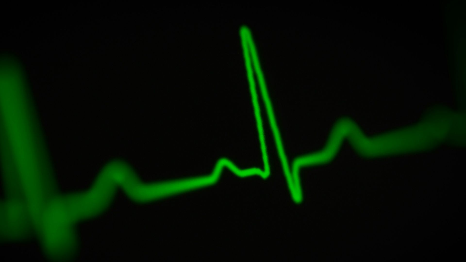 8. Rythme cardiaque irrégulier