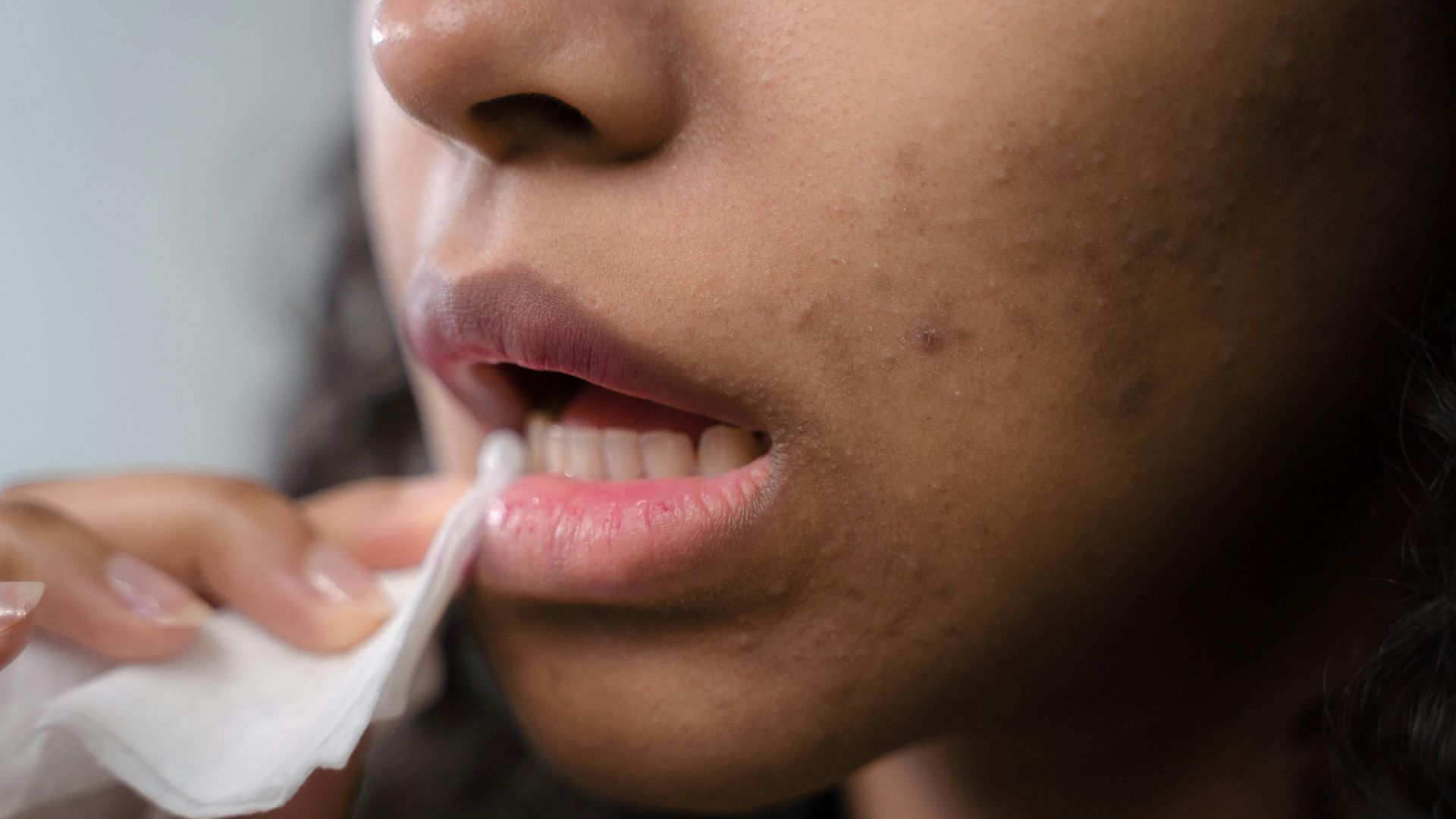 18. Éponger les lèvres avec un mouchoir en papier