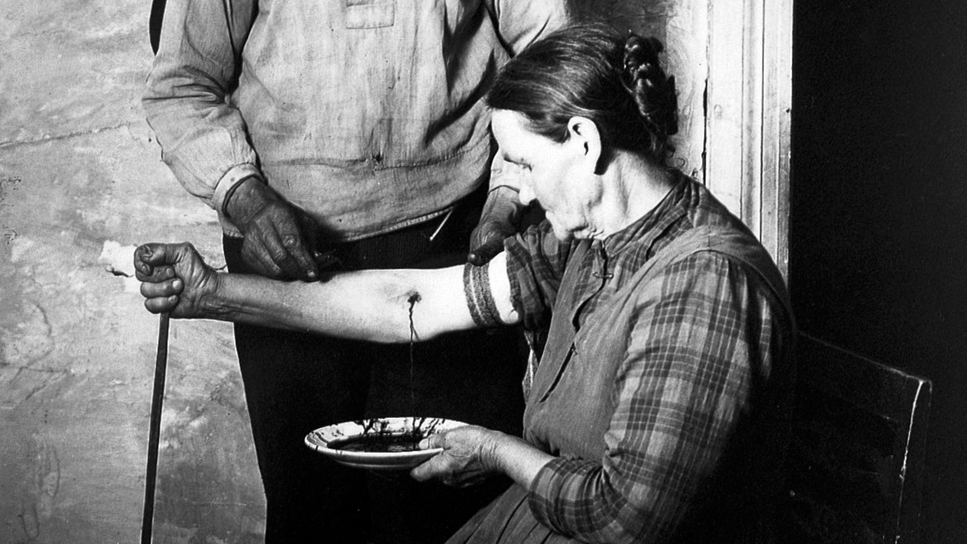 20 procédures médicales les plus étranges de l’histoire