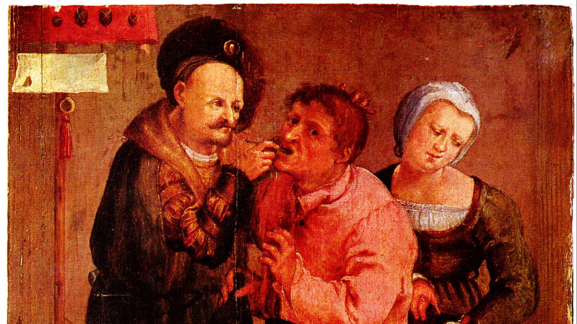 4. Transplantations de dents chez les pauvres