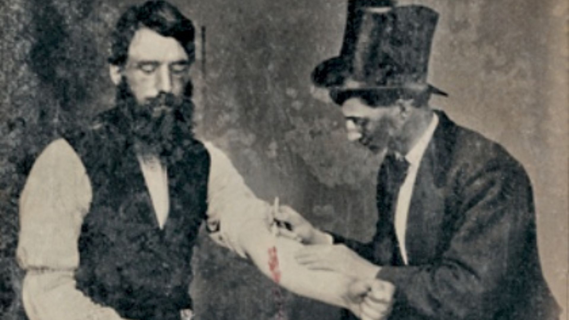 7. Des saignées pour pratiquement tout