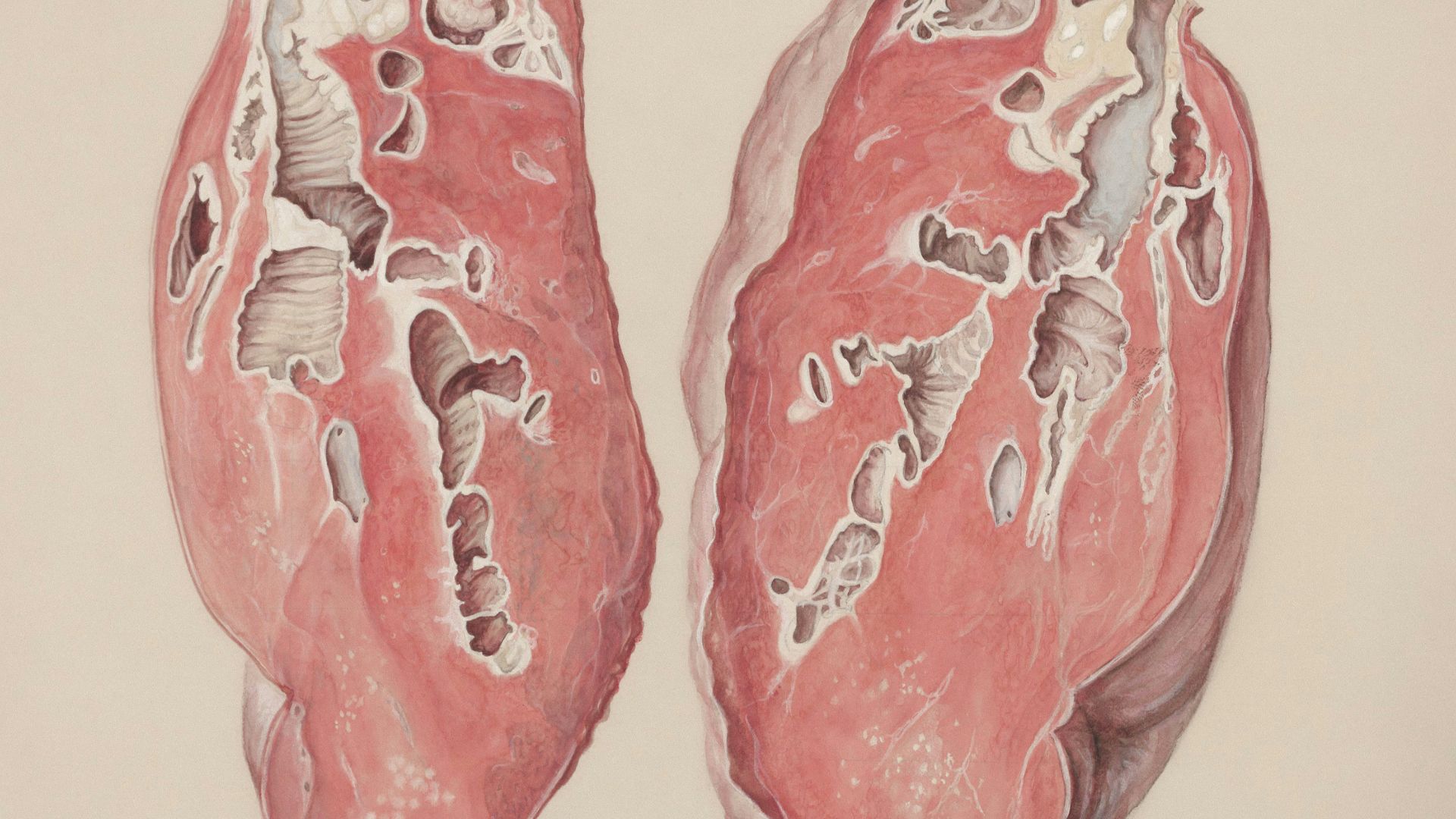 9. Les problèmes de thyroïde sont souvent en cause