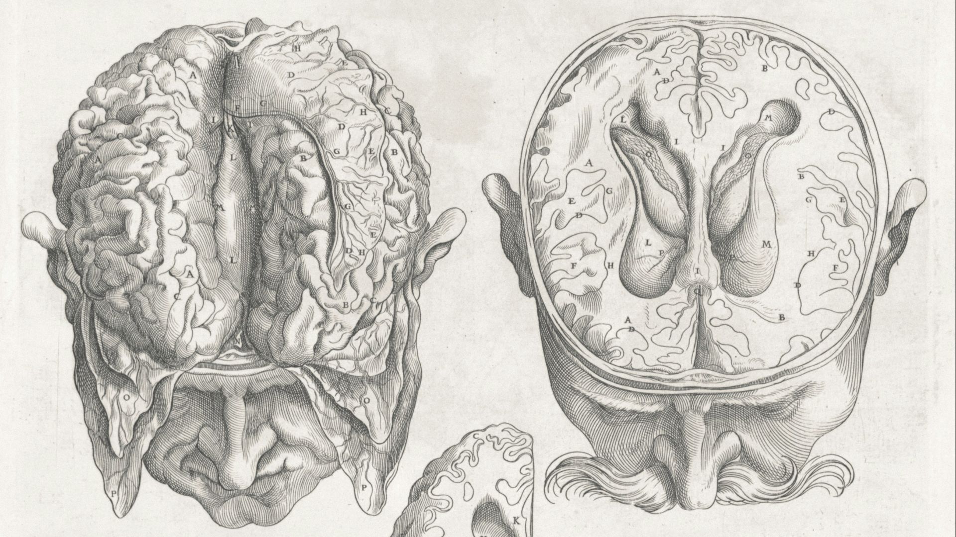 3. Méningo-encéphalite amibienne primaire