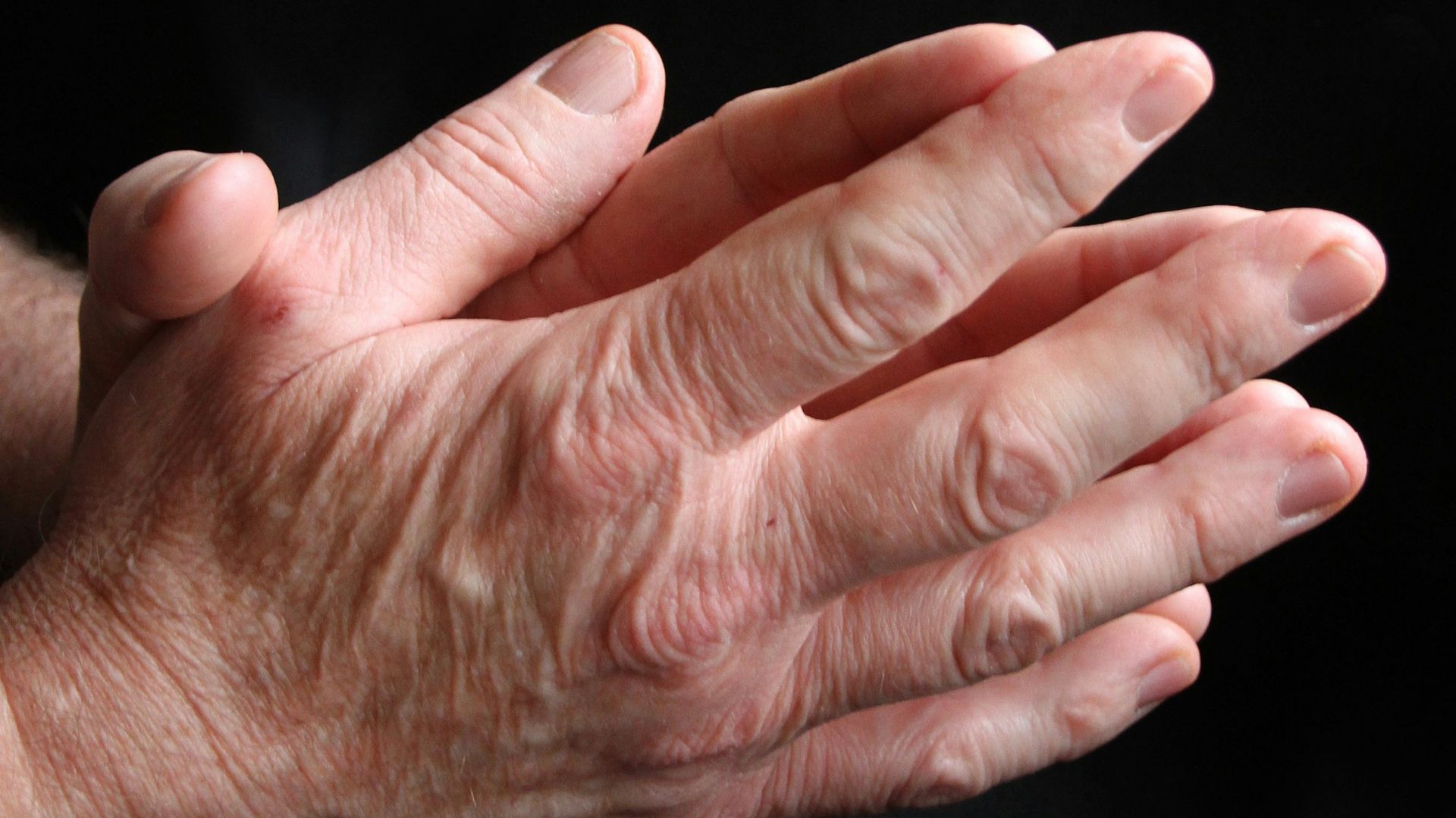 2. Se faire craquer les doigts provoque de l'arthrite