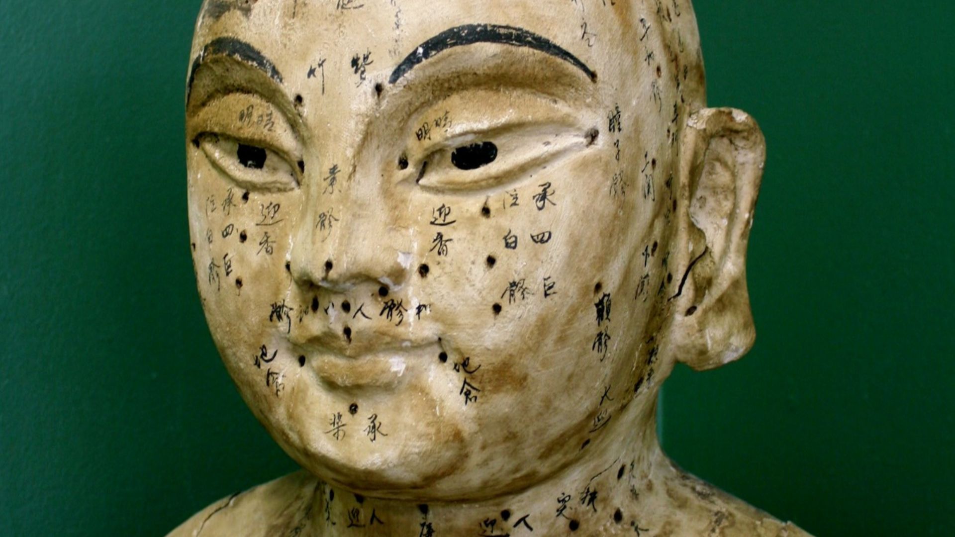 1. L'acupuncture a vu le jour en Chine il y a plus de 2 500 ans 
