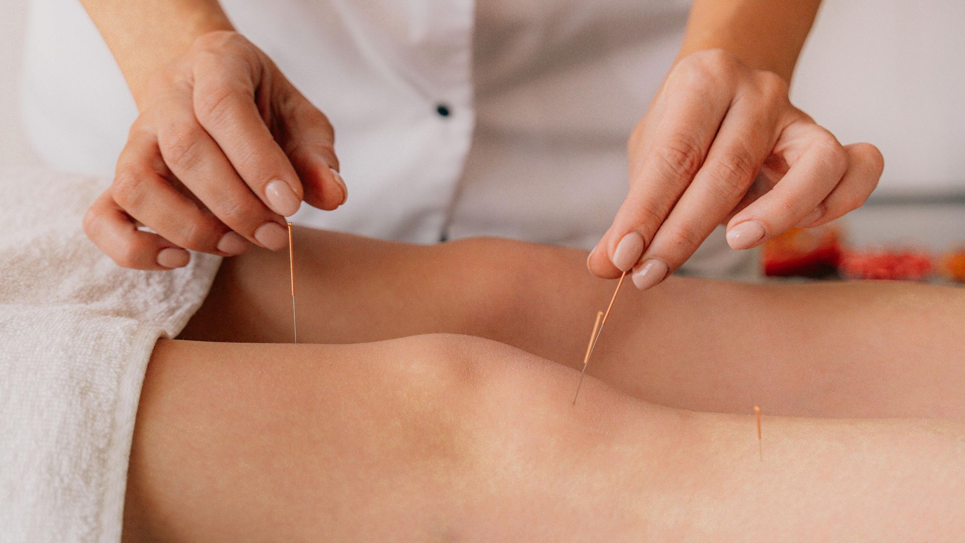 8. L'électroacupuncture utilise une stimulation électrique douce