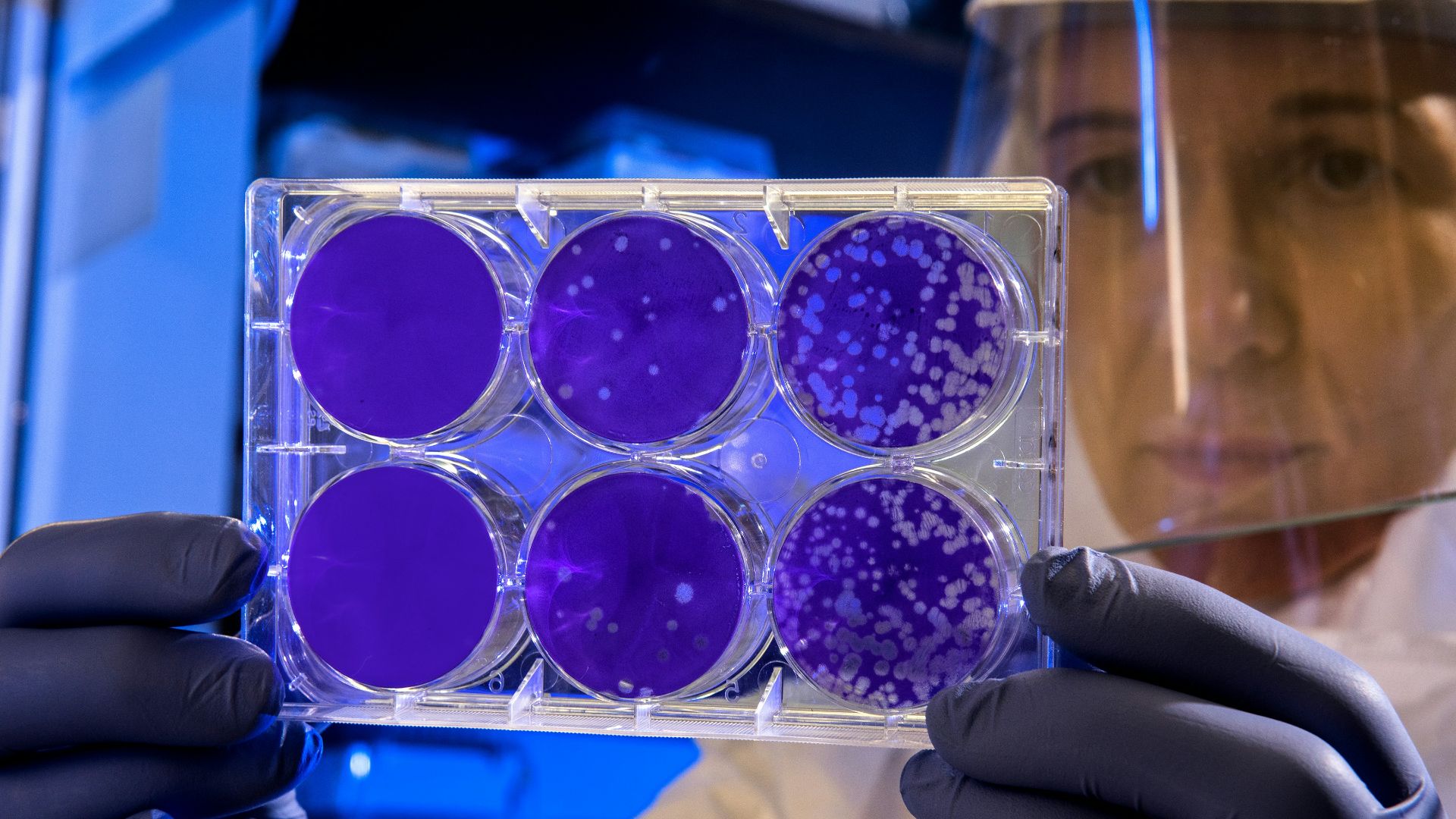 20 choses surprenantes que votre microbiome intestinal peut révéler sur vous