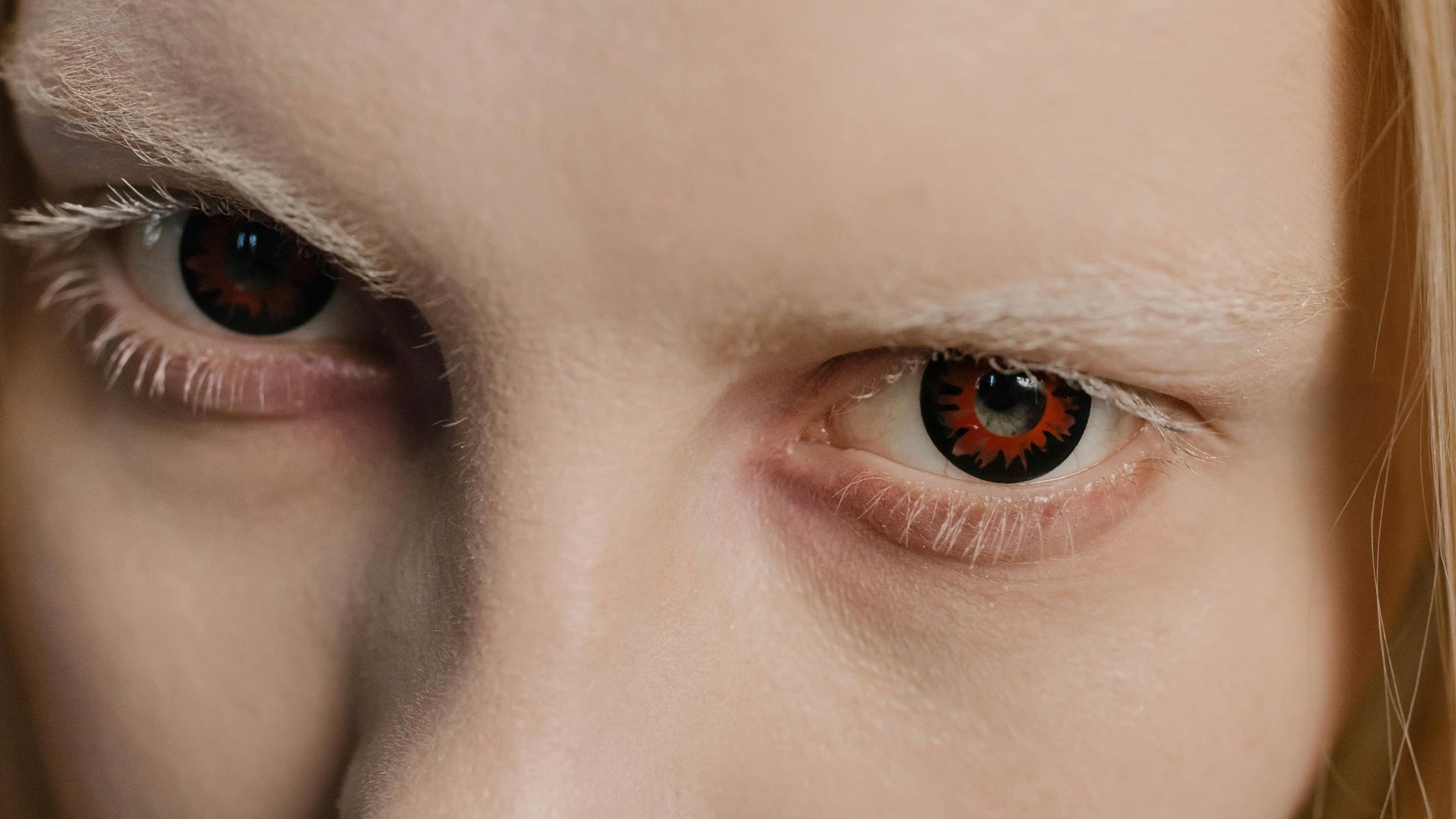 10. Utilisation excessive ou mauvais ajustement des lentilles de contact