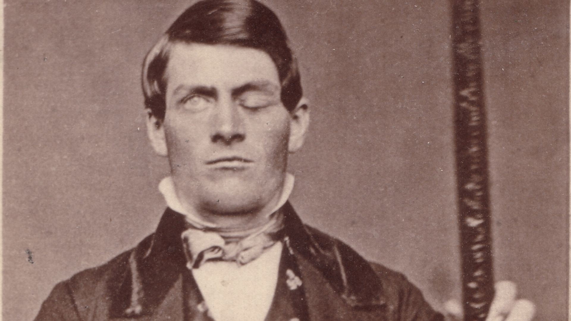 7. Phineas Gage