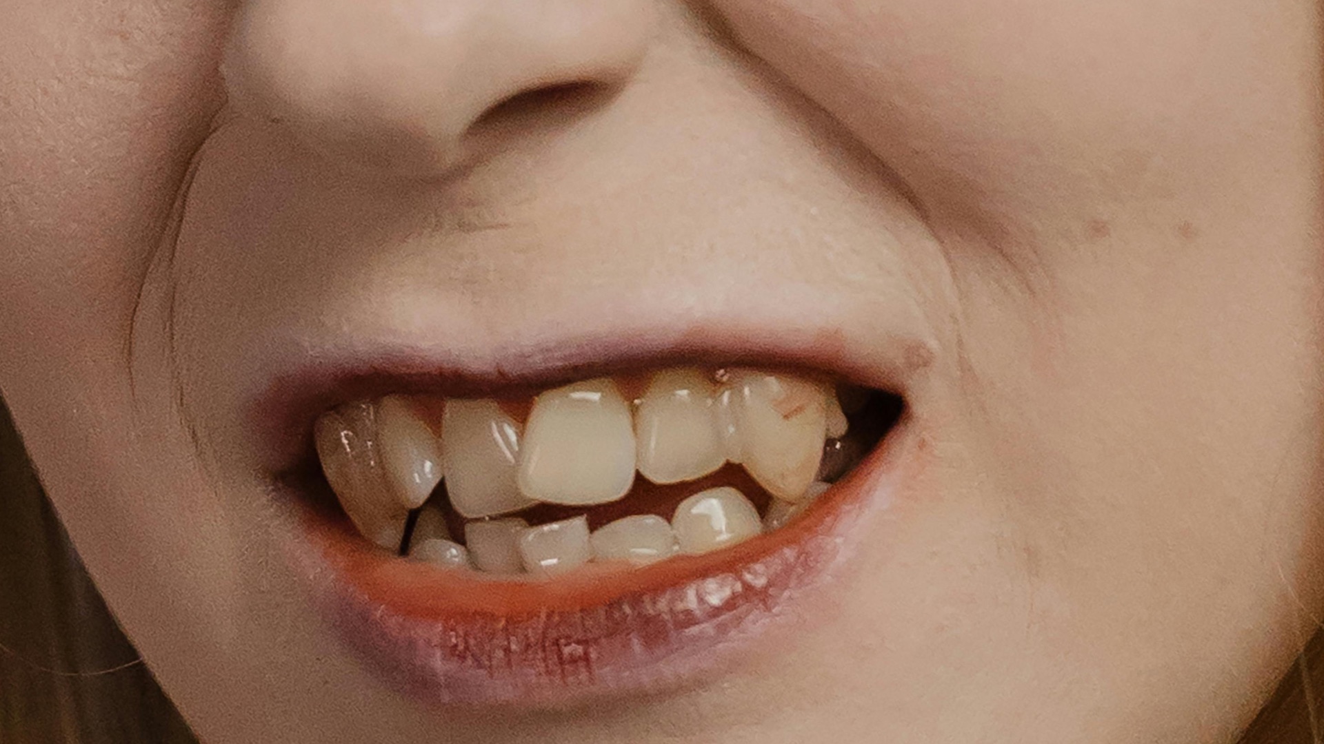 5. Les frères Carter