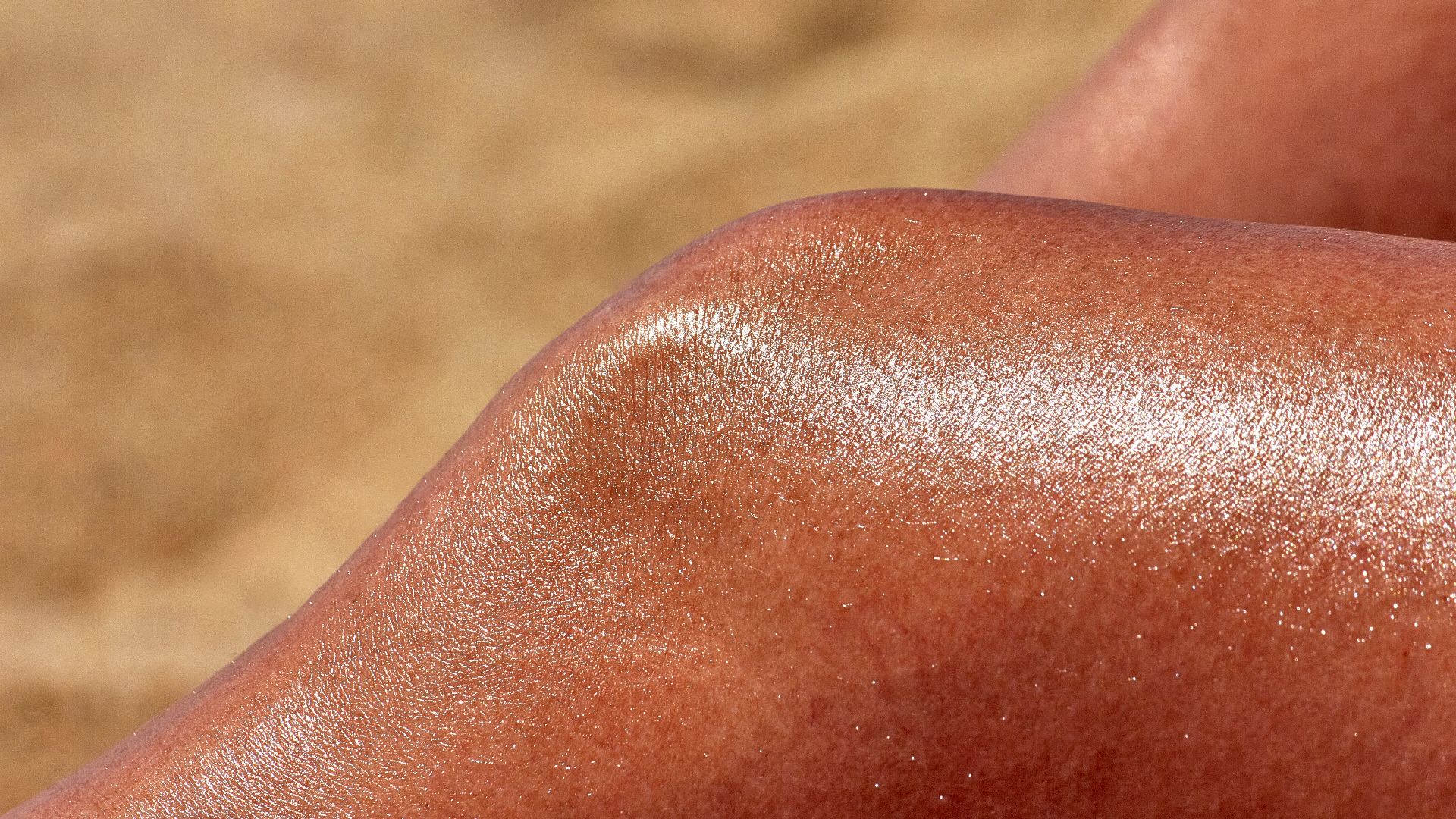 1. Coup de soleil