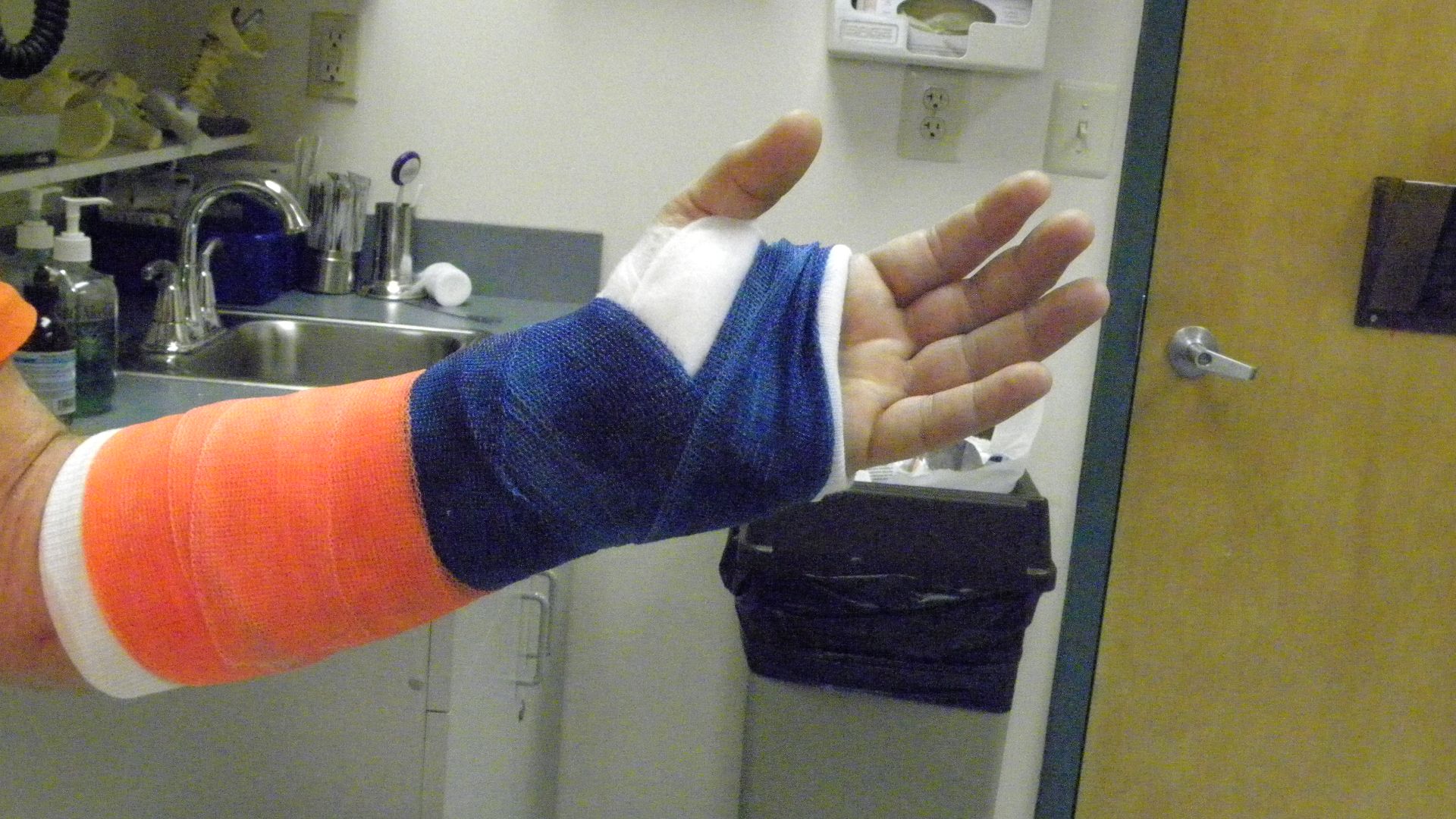 10. Ulna (corps, isolé)